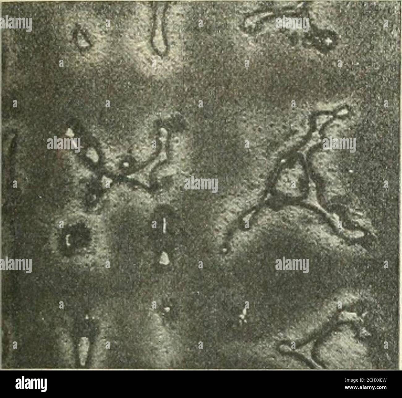 . Journal . mäßig schnelle coolou:, wie oiquenching, oder Kühlung in der Luft. Oder die Schlange wurden Wasser ainl auf über SOI aufgewärmt (. Sind fast ssorbitic im Charakter. Solche Boden-Cording zu meinem eigenen expcrii stärker und weniger haftbar zu brechen utifiber Belastungen als weniger sorbitic Material. Xujiinuirij und Schlussfolgerungen. Die Beweise scheinen deutlich zu zeigen, nämlich: - 1.. Dass bei einer bestimmten Temperatur- in der Nähe, aber der Eutektie-Punkt des Eisen-Phosphor-eulectic, Bestandteile, wenn ziemlich fest sind in der Lage -von einem Teil zum anderen. 2. I Inn ist ein Beweis dafür, dass die großen Kristallinin-Feststoffe ha Stockfoto