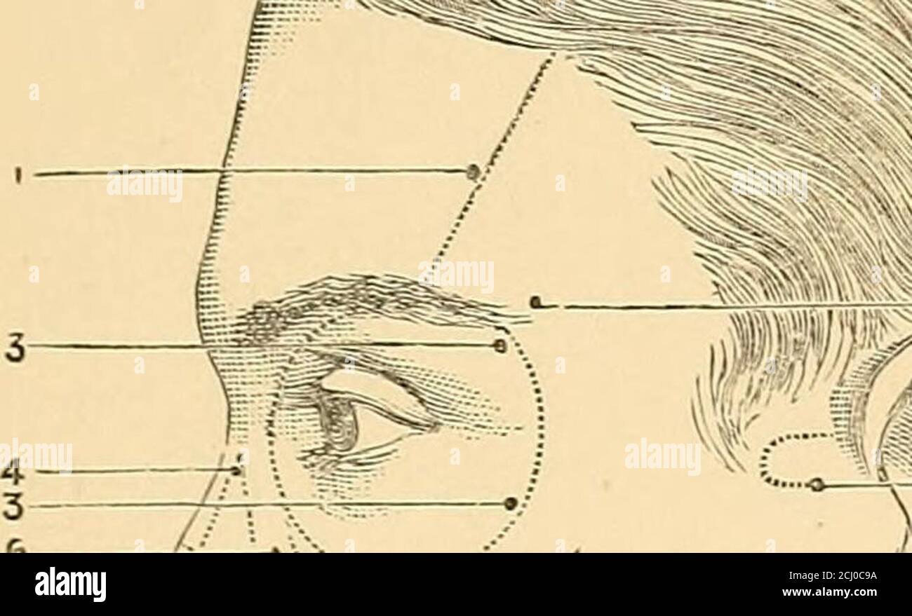 . Eine praktische Abhandlung über Elektrodiagnostik bei Erkrankungen des Nervensystems . Vorderbauch des Digastric Muskel. 20. Ibotorpunkt des hinteren Bauches des Digastric Musculus. 21. Stamm des Nervus hypoglossus. 22. Motorischer Punkt des Muskels Sterno-mastoid. 23. Trapezmuskel. 24. Motorischer Punkt des Musculus splenius capitis. 25. Muskel Splenius Colli. 26. Musculus levator anguli Scapulse. 27. Posteriorer Skalenusmuskel. 28. Mittlerer Skalenusmuskel. 29. Musculus scalenus anterior. 30. Hinterer Bauch des Muskels Omo-hyoid. 31. Musculus sterno-hyoid. 32. Motorischer Punkt des vorderen Bauches des Musculus Omo-hyoid, 33. Motorpunkt o Stockfoto