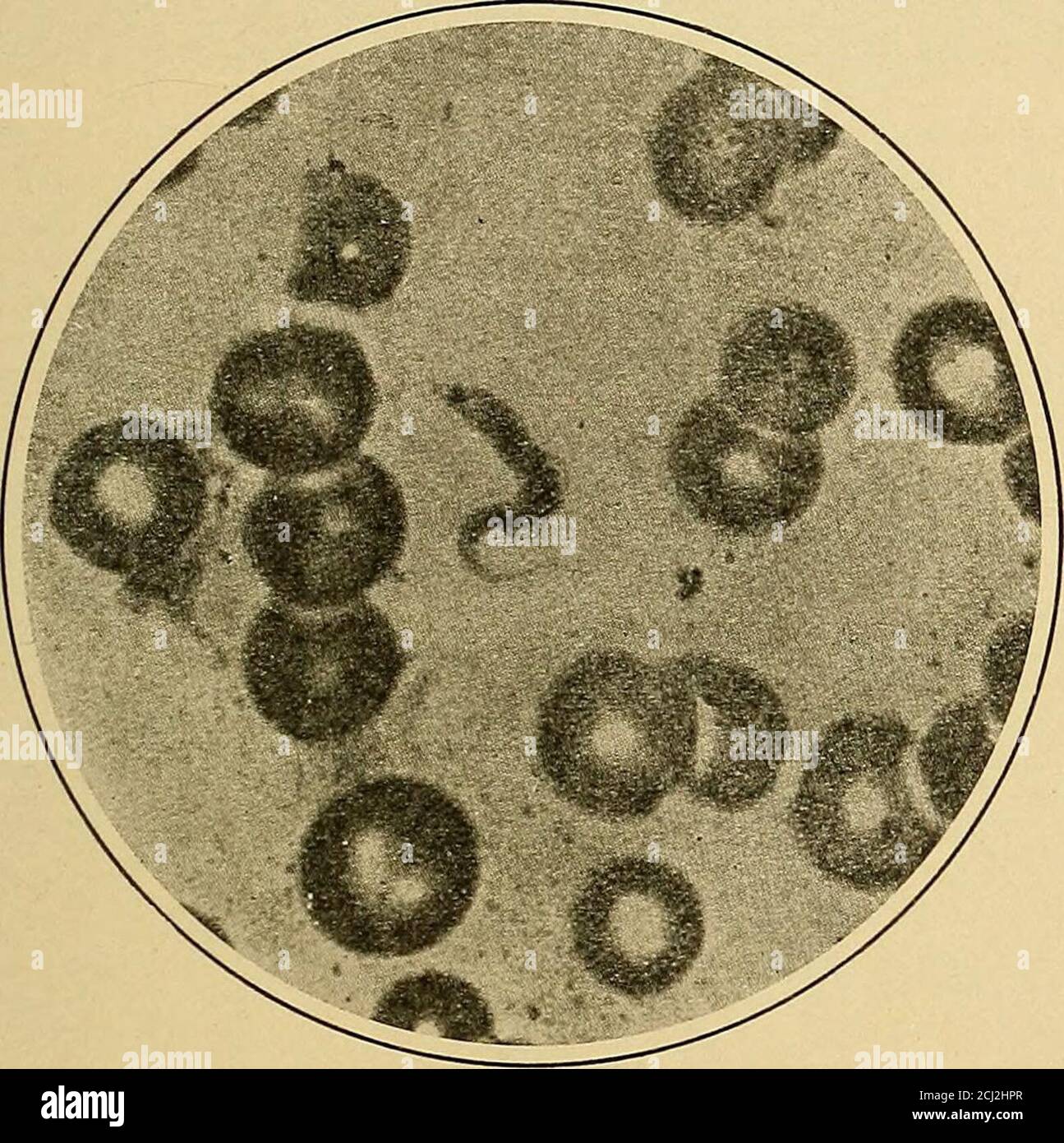 Trypanosoma parasite -Fotos und -Bildmaterial in hoher Auflösung – Alamy