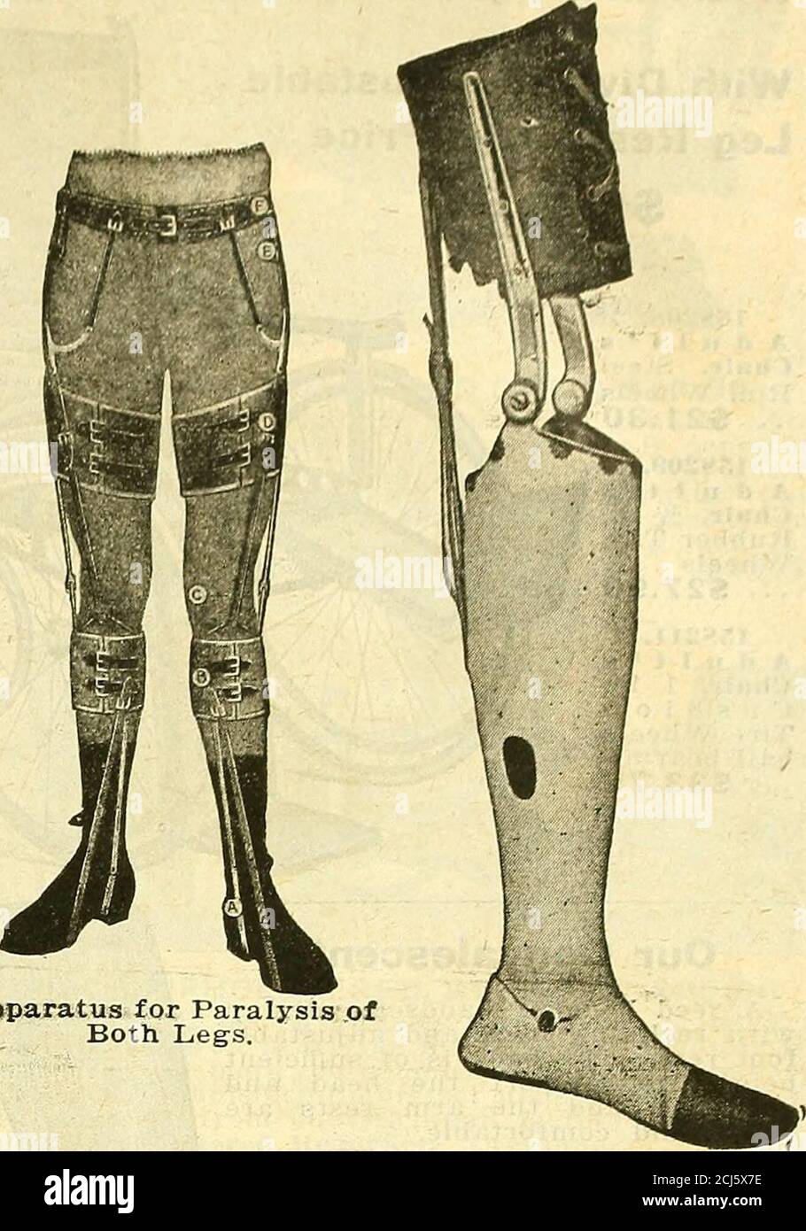 . Diese Scheibe gehört Ihnen : Provision des Agenten, wenn Sie von Betz kaufen : spezielle chirurgische Bulletin für den Sommer, 1916 . Apparat zur Lähmung der Beinchen. 11S7201Für unter dem Knie Amputation, mit Triple Action Sprunggelenk 75 €.OO gleiche Bein-, mit Gummifuß. Preis 65.00 Schreiben Sie für Kreis- und Maßrohlinge. D Wir machen eine spezielle Linie von Zahnspangen für DIE LÄHMUNG VON KLEINKINDEN. Senden Sie das Rundschreiben. Lassen Sie uns wissen, welche Teile betroffen sind und wir werden die notwendigen Informationen über Zahnspangen für jeden Fall WEITERLEITEN ANWEISUNGEN FÜR DIE DURCHFÜHRUNG VON MESSUNGEN E&nc STRUMPFWAREN Nehmen Sie den exakten Umfang an den Punkten durch let angegeben Stockfoto