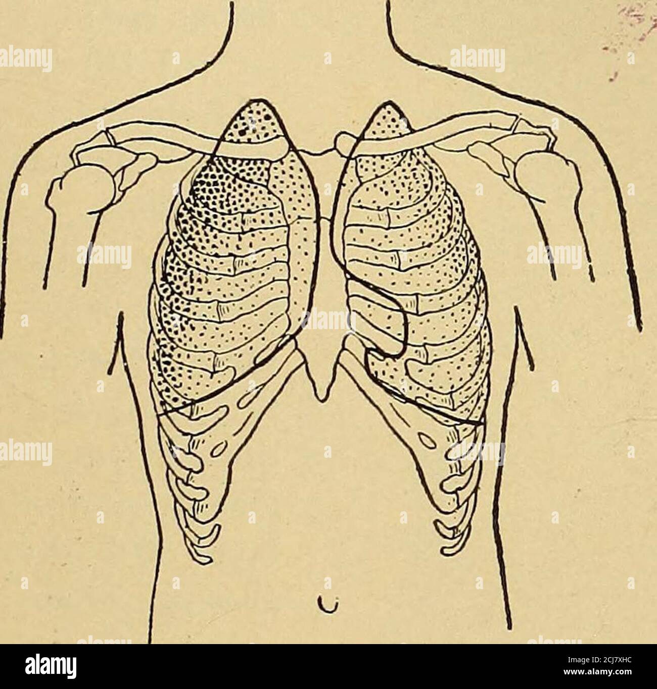 . Physische Diagnose . SE die gleiche Menge an Kraft jedes Mal, wenn er wieder peats sie und etwa die gleiche Tonhöhe der Stimme zu verwenden. » Andere Dinge sind gleich, der Fremitus ist größer hallo Männer als Frauen, bei Erwachsenen als bei Kindern, und ist mehr in thosewessen Stimmen sind tief als hallo diejenigen, deren Stimmen rela-thinely schrill sind gekennzeichnet. Die Menge des Fremitus variiert auch sehr stark in verschiedenen Teilen der gesunden Brust EIN Blick auf Abb. 64 wird uns helfen, dies zu torealisieren die dunkelsten schattierten Teile kommunizieren, um die Finger PALPATION UND DIE STUDIE DES PULSES. 99 der am meisten markierte Fremitus, während im pa Stockfoto