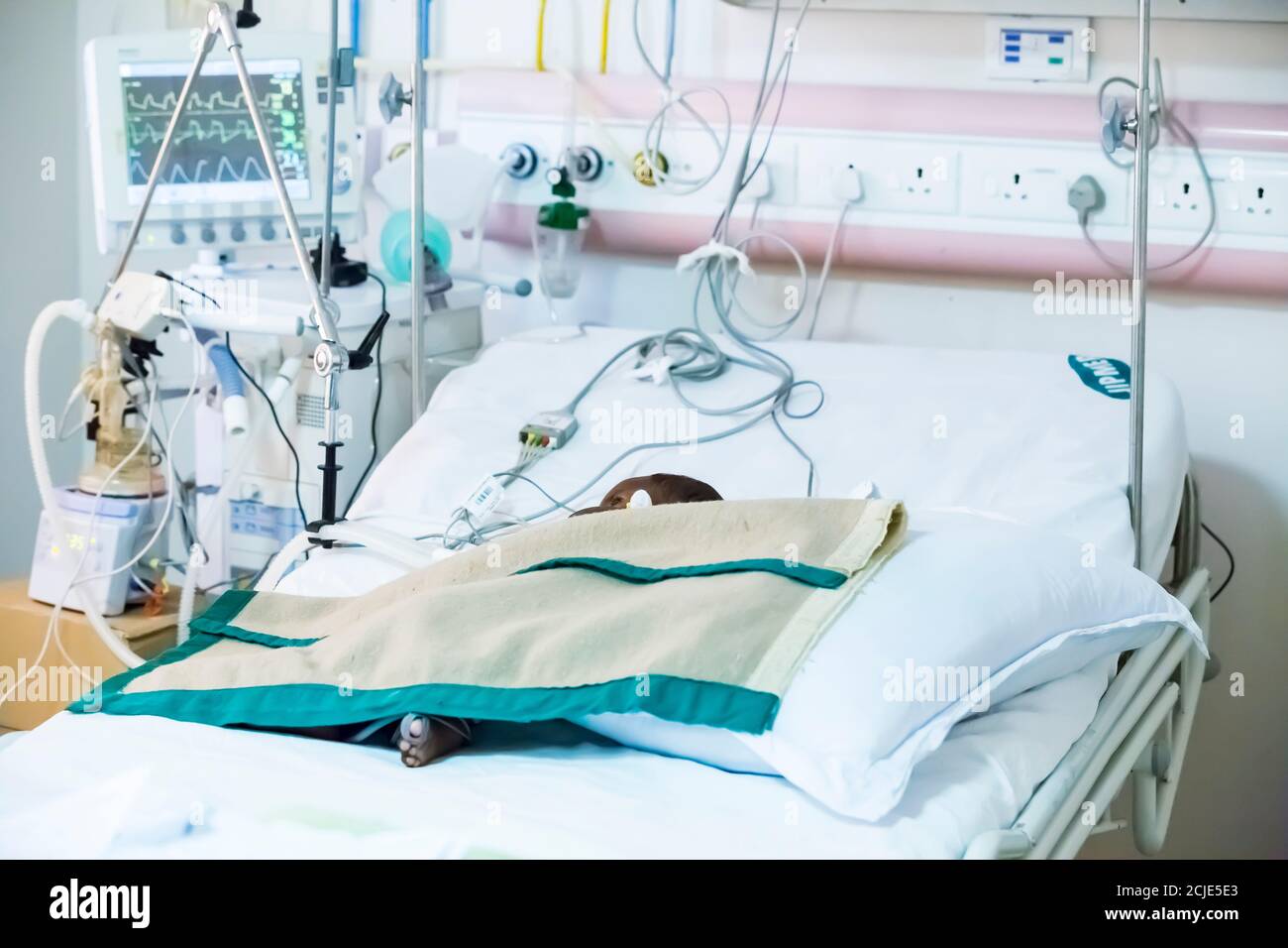 PUDUCHERRY, INDIEN - MÄRZ CIRCA, 2020. Baby auf einem großen Bett auf einer künstlichen Lungenventilation Ausrüstung im indischen Krankenhaus platziert. Lungenentzündung diagnostizieren. C Stockfoto