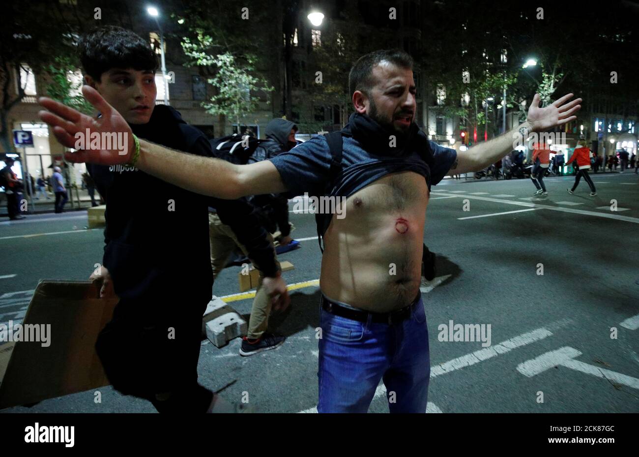 Katalanischer Unabhängigkeitsdemonstator zeigt eine Wunde, nachdem er während eines Protestes gegen Polizeiaktionen in Barcelona, Spanien, am 26. Oktober 2019 mit einer Plastikkugel von der Bereitschaftspolizei erschossen wurde. REUTERS/Albert Gea Stockfoto