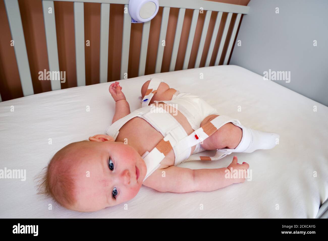 4 Monate altes Baby mit Hüftdysplasie behandelt Ein Pavlik Geschirr Stockfoto