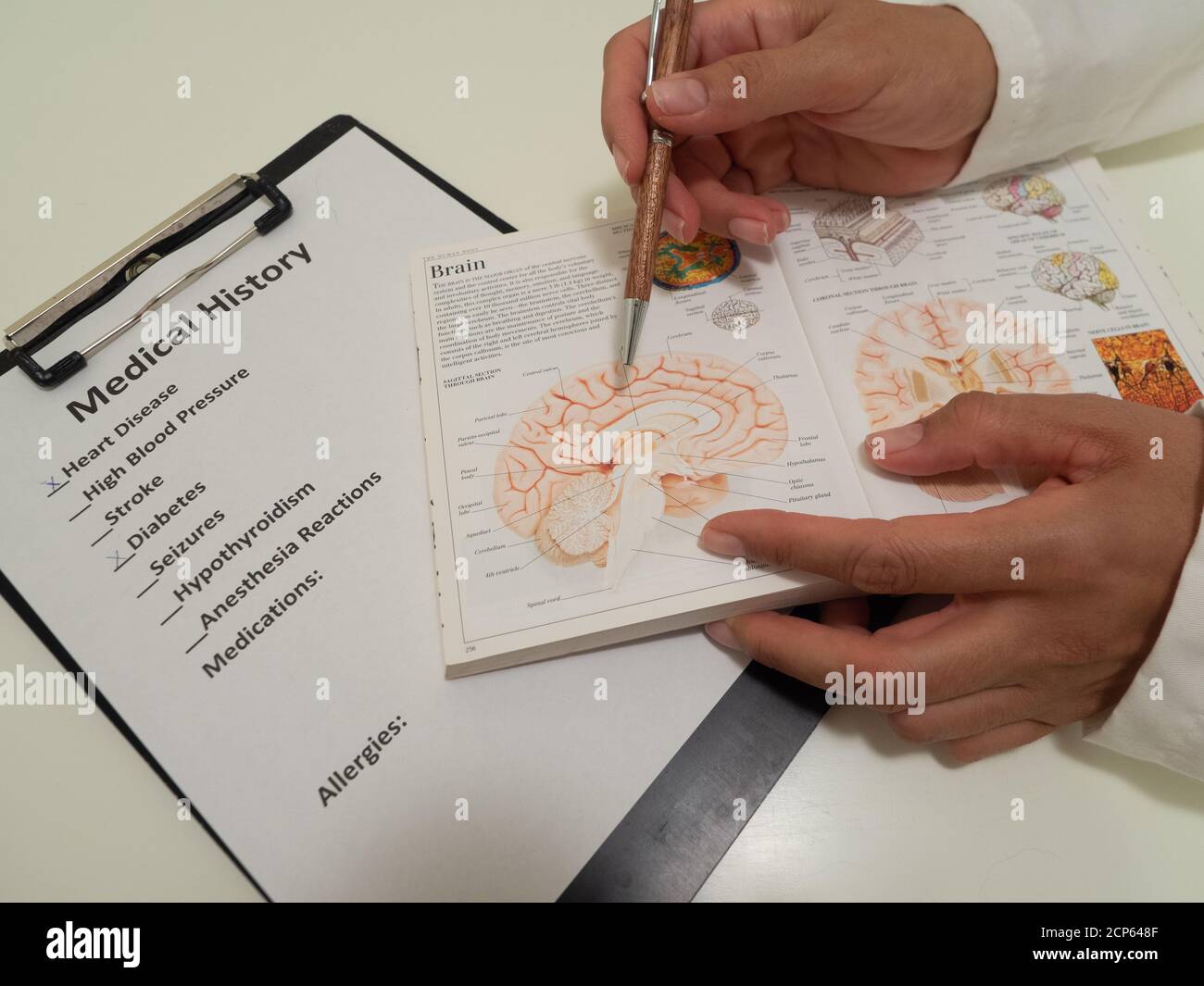 Nahaufnahme der Hände einer Latina-Ärztin, die die Anatomie des Gehirns in einem Lehrbuch mit einer medizinischen Form auf dem Foto zeigt. Stockfoto