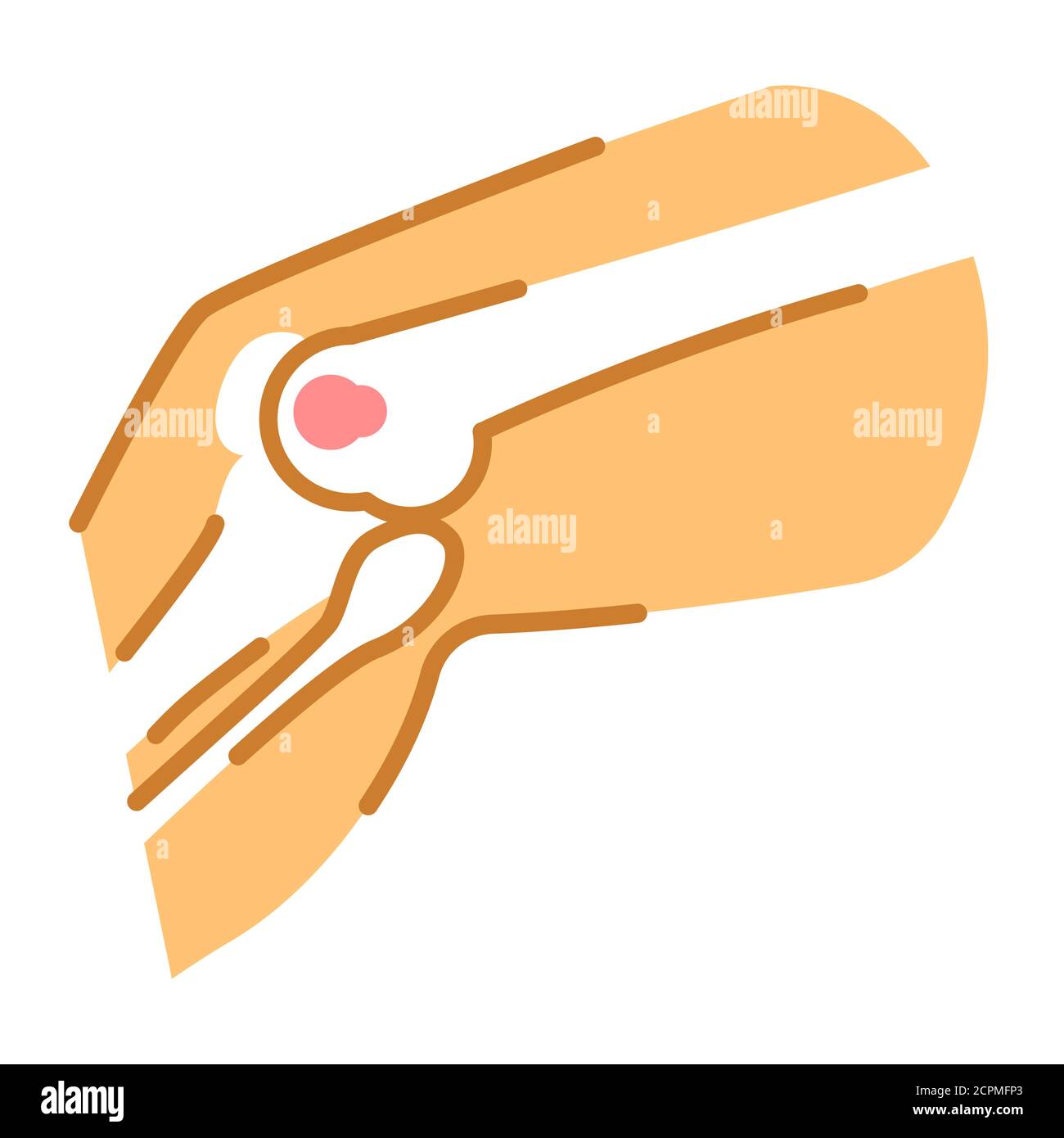 Beim osteosarkom kaufen Alamy