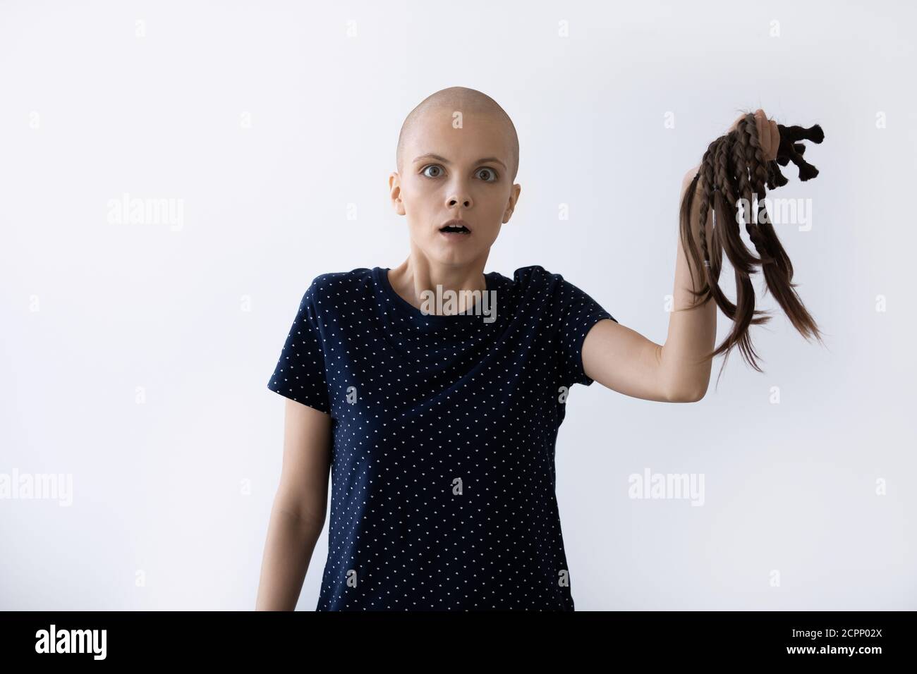 Ängstlich kranke Glatze Frau kämpfen mit Krebs Haare verlieren Stockfoto