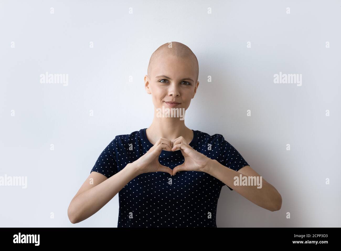 Kopfschuss Porträt der haarlosen kranken Frau zeigen Herz Geste Stockfoto