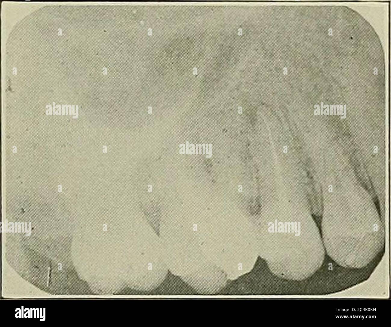 . Zahnärztliche und orale Radiographie; ein Lehrbuch für Studenten und Praktiker der Zahnmedizin . Stockfoto