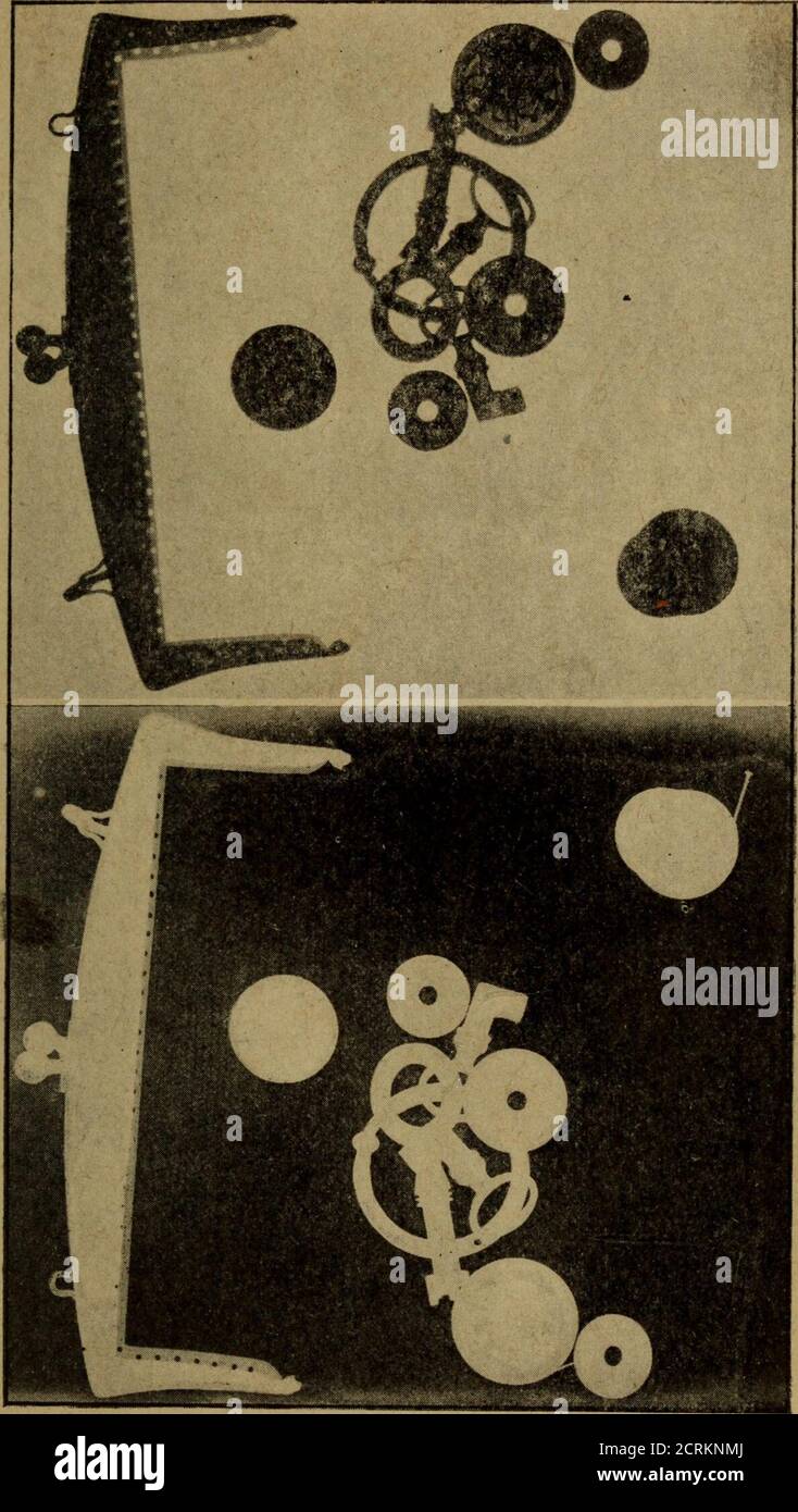 . La radiologie et la guerre . ©tÃ©s des rayons X sont prÃ©cisÃ©-ment celles que nous utilisons dans la Radio-logie. Les rayons traversent, en effet, diffÃ©-rentes substances dautant plus facilement quecelles-CI sont moins denses (plus exactement,le pouvoir pÃ©nÃ©trant des rayons estdautantplusgrand que le poids atomique de la substance Ã traverser est plus faible). SI un faisceau derayons X issu du Foyer dune anticathodeatteint un Ã©cran radioscopique (Ã©cran au plati-nocyanure de baryum) au travers dun objet telquun porte-monnaie en cuir contenant despiÃ¨ces de monnaie, le cuir est traversÃ© Stockfoto