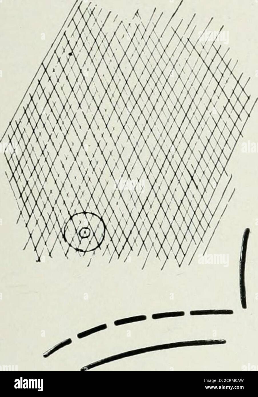 . Die Roentgen Strahlen in Medizin und Chirurgie als Hilfsmittel in der Diagnose und als therapeutisches Mittel; für den Einsatz von Praktikern und Studenten konzipiert. On und Percussion. John H., 60 Jahre alt, trat am 30. Dezember 1899 in meinen Dienst im Boston City Hospital ein. Diagnose : alte Tuberkulose. Eine sorgfältige Untersuchung auf Tuberkelbazillen war negativ. Die physischen Zeichen waren wie folgt: Herz: Rechter Rand 3 centi-Meter rechts von Medianlinie; linker Rand 14.5 Zentimeter links von Medianlinie; oberer Rand an zweiter Rippe; Scheitelpunkt im fünften Raum, 2.5 centi-Meter außen; kein Murmeln. Lunge: Stumpers Stockfoto