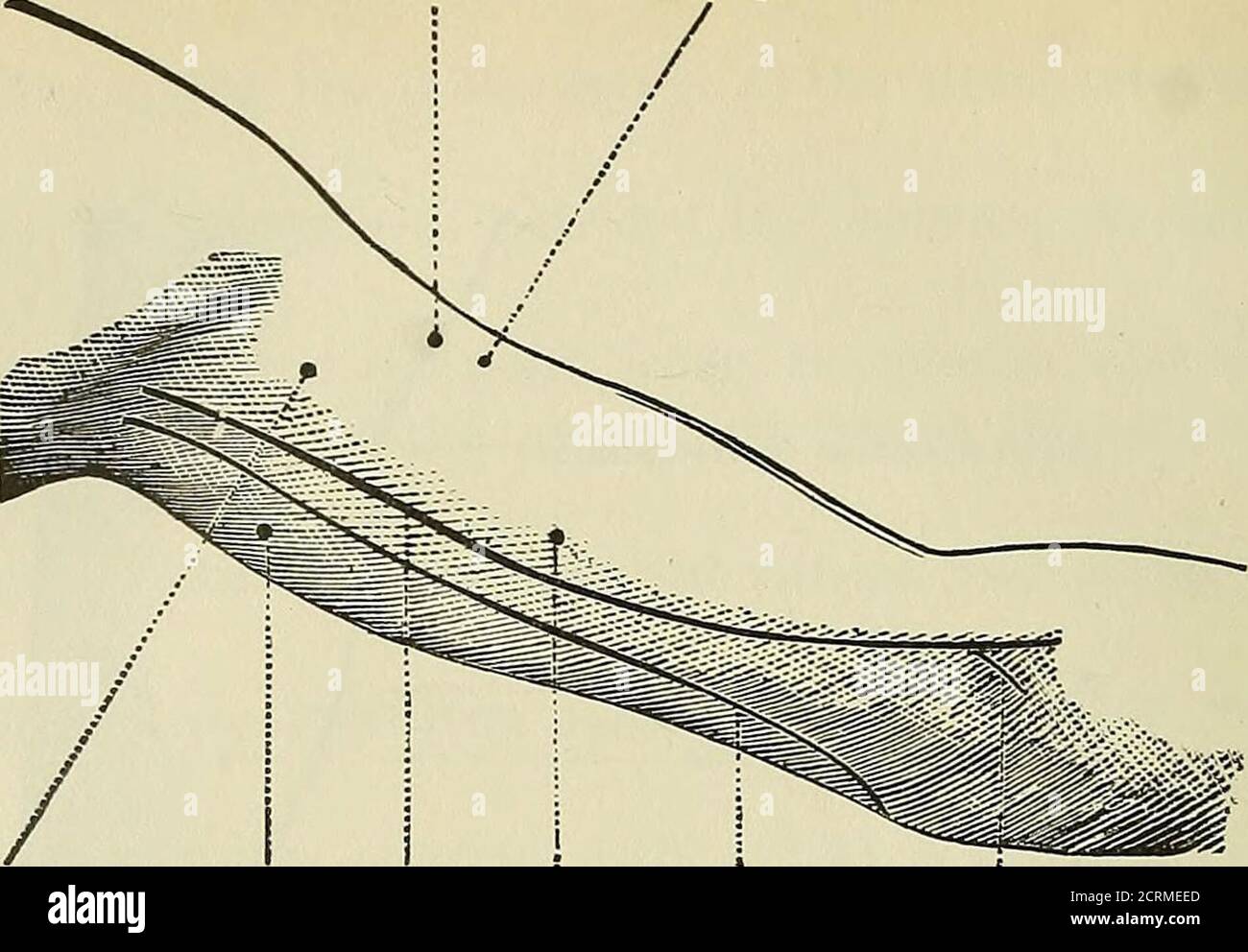 . Röntgenstrahlen und Elektrotherapeutika : mit Kapiteln über Radium und Phototherapie . .M. ulnaris e::^ternus. M. extensor digiti minimi pro-prius. M. extensor indicis proprius.M. extensor pollicis longus. M. abductor digiti minimi.M- interosseus dorsalis IV. Abb. 37. – motorische Punkte des Unterarms und der Hand. 60 ELEKTRO-THERAPEUTIKA. N. musculo-cuianeus. M. Bizeps... N.musculo-Caput in- N. Media- ; N. ulnaris. Rami N. medianicutaneus. Ternus M. nus. M. brachialis pro M. pronatore tricipitis. ■internus. Radien terete. Abb. 38. – Motorpunkte des Arms (Vorderansicht). Rami Nervi mediani pro M. pronatore ra Stockfoto