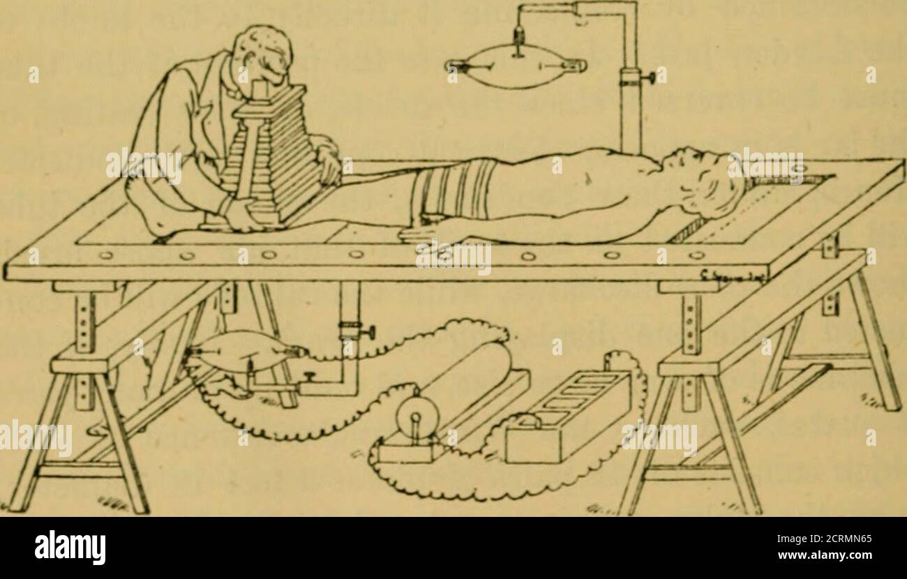 . Radiographie und die 'X' Strahlen in Praxis und Theorie: Mit konstruktiv manipulatorischen Details. Fio. 35.-- Seouys AKKAMiKMt.M 1 uii Vkrtical Examination. Fio. 36. – Seguy8 Arhasoement fou Horizontale Untersuchung ALLGEMEINE MANIPULATOItY DETAILS 139 verschoben. Zum Zwecke der Erhöhung der Penetrativepower der Röntgenstrahlen, können Spulen von etwa 300 Umdrehungen von Nr. 30seidenbedecktem Kupferdraht ])e in die Oberjar-Schaltung eingefügt werden, wie in § 10 erwähnt. Diese Spulen sollten in einem Glasstab bestehen, ca. J in. Im Durchmesser, 3 oder 4 Zoll lang, über die der Draht dicht gewickelt wird undohne Überlappung von Ende zu Stockfoto