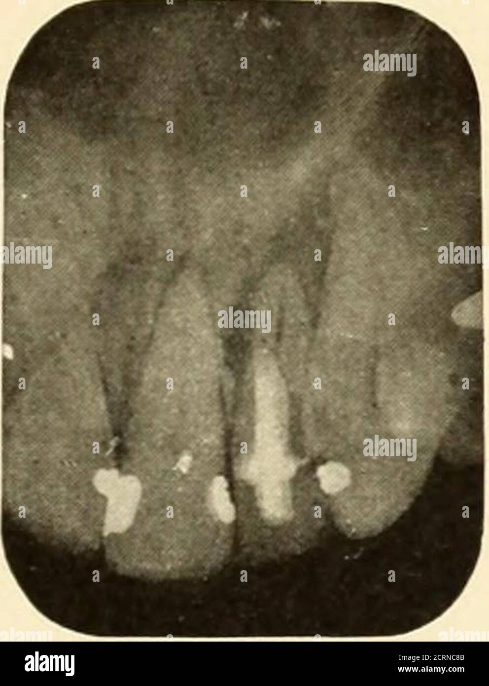 Orale Roentgoenologie : eine Roentgen Studie der Anatomie und ...
