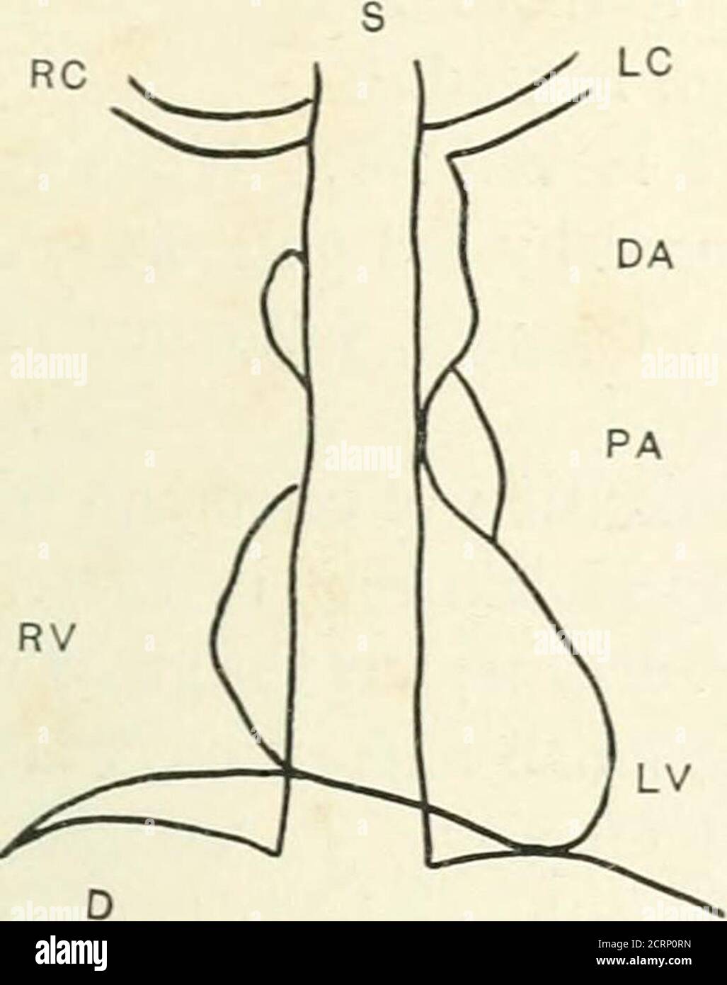 . Radiographie, Röntgentherapeutika und Radiumtherapie . PLATTE XL. – Truhen zeigen Aneurisji und Xkw Wachstum. a. Aneurismus der absteigenden Aorta, lateral. h. Gleicher Fall antero-posterior jiosition. c, sekundäres Wachstum in mediastiuum, simuliert Aneurismus. AORTA ANEUEISM 207 von der Größe des Herzens und Aorta auf einem Papier vor oder hinter dem Patienten, ein etwas kompliziertes mechanisches de^-Eis notwendig ist. Diese Methode wird in diesem Land sehr selten verwendet, obwohl sie von ausgiebig verwendet wurde. Stockfoto