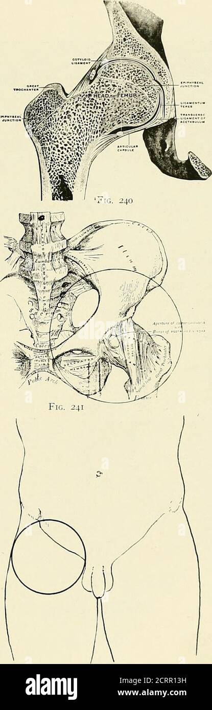 . Die Prinzipien und Praxis der roentgenologischen Technik . Ameisen, und die Oberfl. Von Welle 2. Sitzhöcker 3. Sacro-Iliac-Gelenk, Unterteil Exposures 1. Verttro-dorsal 2. Dorso-ventral (bringt Knochen näher an die Platte – aber nicht so praktisch eine Ansicht als ventro-dorsal) 3. Intero-externer Ventro-DorsalPosture mit iinrrrsion des Fußes (innere Rotation des Oberschenkels) Hals wird verlängert Grosser Trochanter prominenter kleiner Trochanter nicht sichtbar (Hals liegt parallel zur Aufnahmefläche) mit Eversion des Fußes (nach außen Rotation des Oberschenkels) Kopf des Oberschenkels ist nach innen gerichtet und nach hinten Hals wird verkürzt größere TRO Stockfoto
