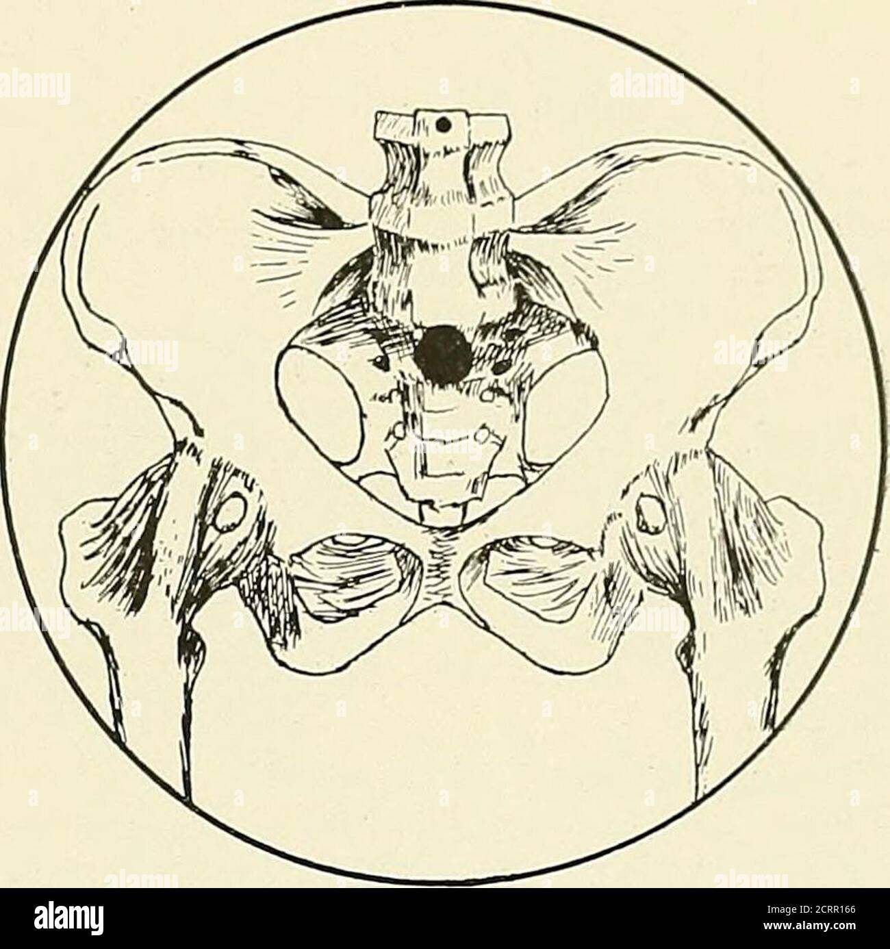 . Die Prinzipien und Praxis der roentgenologischen Technik . ure (Abb. 239) BECKEN 169 BECKEN (Allgemein)Wesentliche Merkmale (Abb. 239a) Ilium und lumbale sakrale SegmentIschium acetabulum und femorale KopfePubis und Symphyse Aufnahmen 1. Ventro-dorsal 2, Dorso-ventrale Schwierigkeiten 1. Die Knochen sind schräg zum hori-zontal und somit gibt es markierteVerzerrung 2. Die Ebene der Beckeneinlass schräg der Platte, macht die Schätzung des Durchmessers schwierig Ventro-DorsalPosture (Abb. 239b) dorsaler Dekubitus perfekt horizontal Hinweis: Deutliche Verzerrung resultiert aus Schrägkippen. ICH Stockfoto