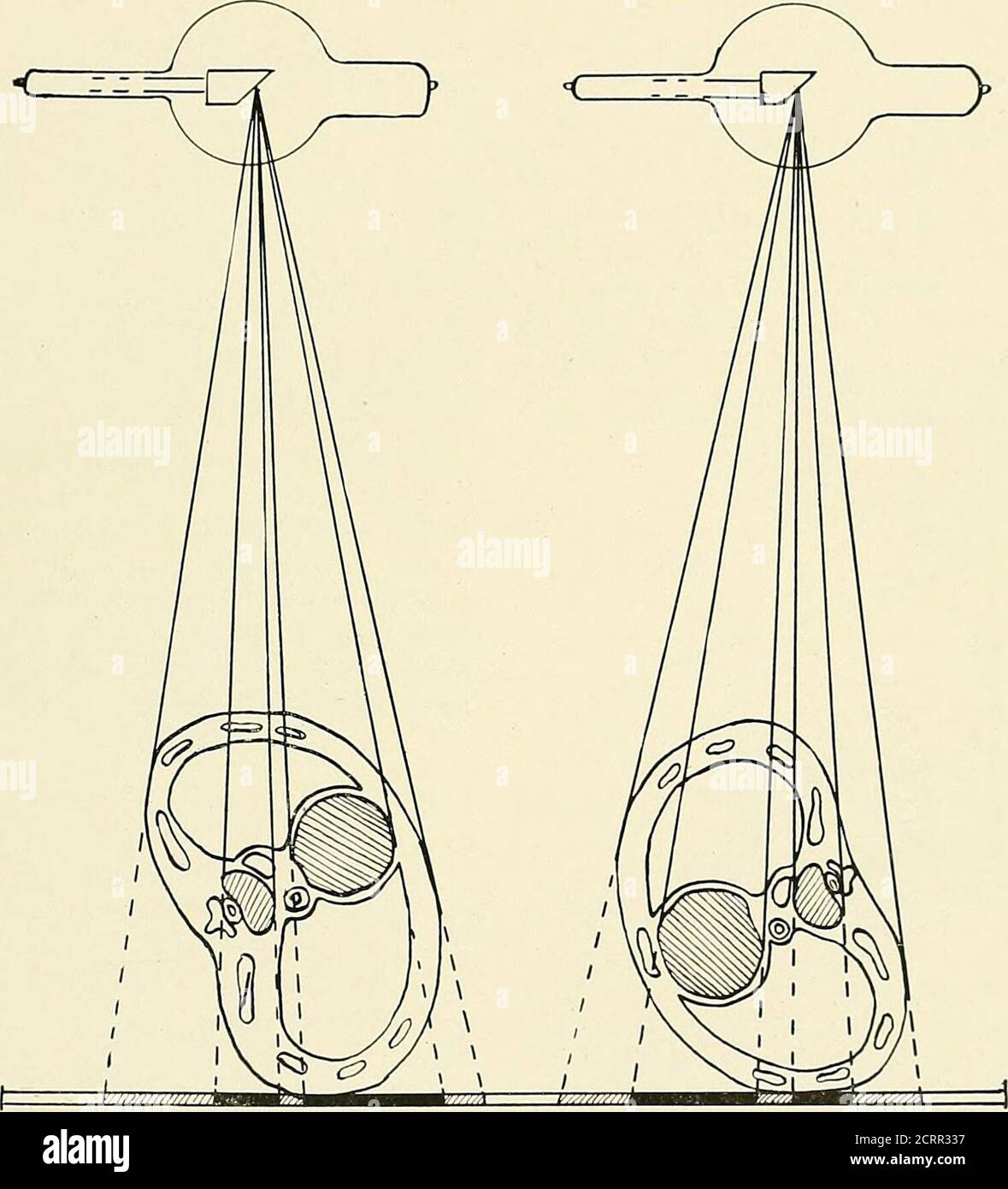 . Die Prinzipien und Praxis der roentgenologischen Technik . Urface im Vordergrund und rechts (Abb. L 186, S. 3. Ventro-dorsale zweite schräge, Röhre vor und nach links, und die Aufnahme Oberflächehinter und nach rechts (Abb. L 188, S. 4. Dorso-ventral zweite schräg, Rohr sein-Hind, und nach rechts, und die Aufnahme sur-Gesicht vor und nach links (Abb. L 188, S. In diesen verschiedenen zentrischen Ansichten ist es das Objekt, das gedreht wird, die Beziehung der Plateto-Röhre bleibt unverändert. Exzentrische ViezvsDie aufzuzählenden Ansichten werden ex-zentrisch genannt, weil der zentrale Strahl nicht mehr ZENTRISCH UND EXZENTRISCH fällt Stockfoto