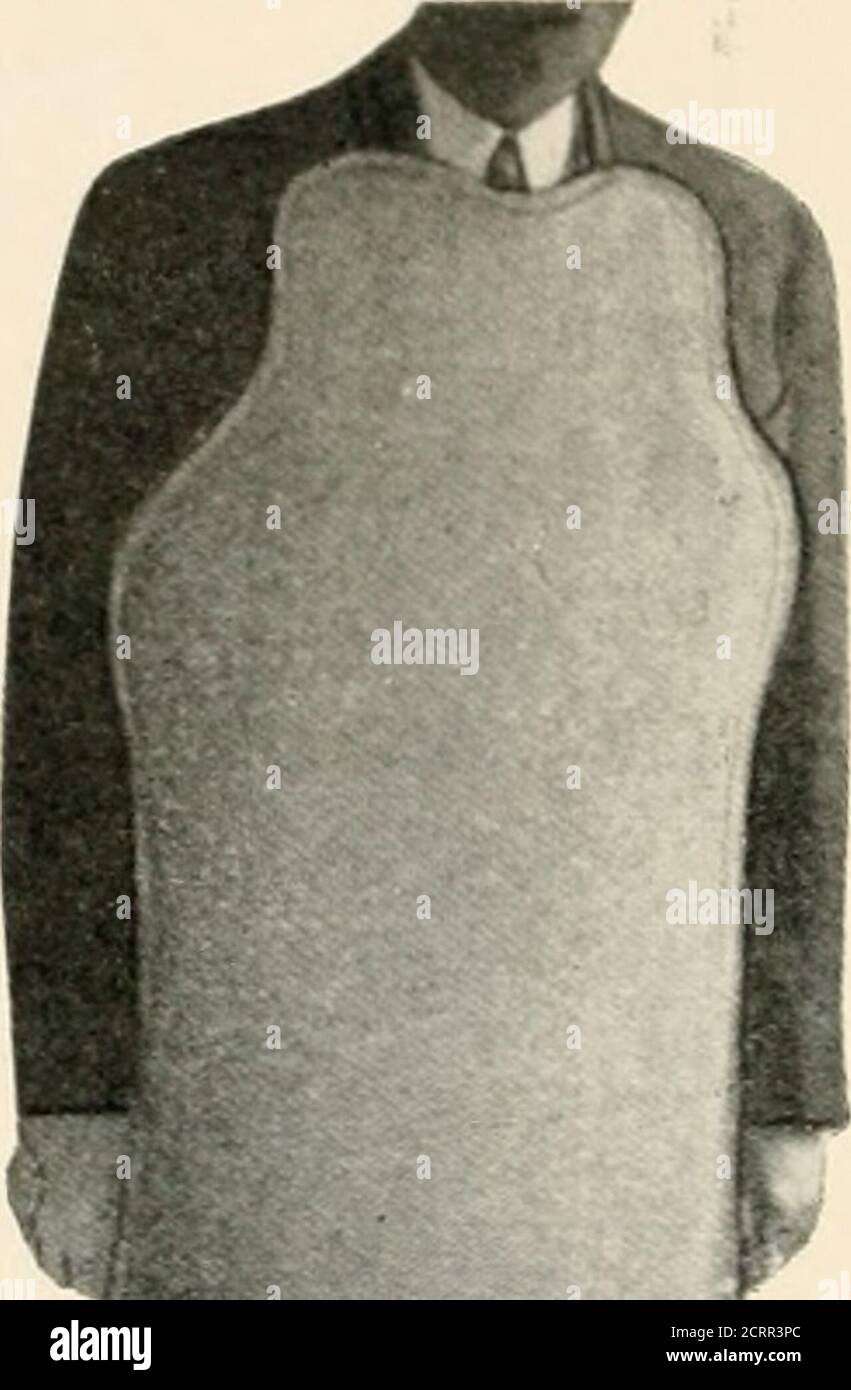 . Zahnärztliche und orale Radiographie : ein Lehrbuch für Studenten und Praktiker der Zahnmedizin . ont der Kontrollapparatur und hat aleaded Glasfenster, so dass der Bediener den Patienten während der Exposition beobachten kann. Bleigetränkte Handschuhe (Abb. 115) und Schürzen (Abb. 116) werden auch von jemandem als Vorsichtsmaßnahme verwendet, aber solche extremen Maßnahmen sind nicht nec-essary für den Zahnarzt, der seine eigene Radiographie macht. Mit einem ordnungsgemäß konstruierten Bleiglasrohrschutz, Bleimembran und Bleizylinder ist der Bediener sicher, sofern er vorsorglich die direkten Strahlen vermeidet. Wir alle erkennen, dass viele ver Stockfoto