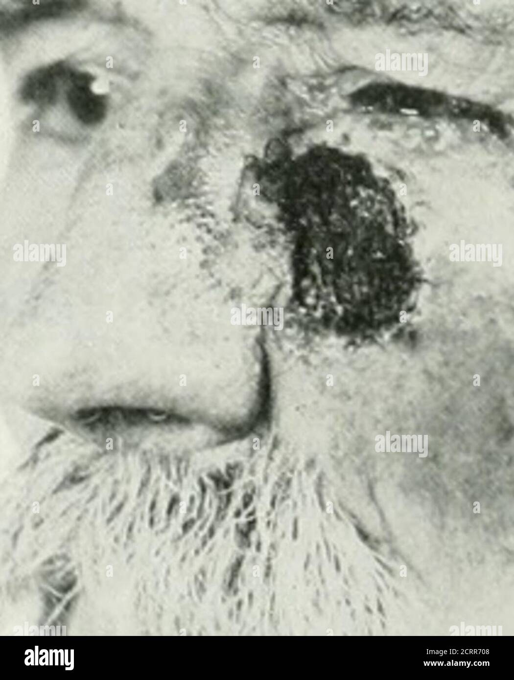 . Die amerikanische Zeitschrift für Roentgoenology, Radium-Therapie und Nuklearmedizin . Stockfoto