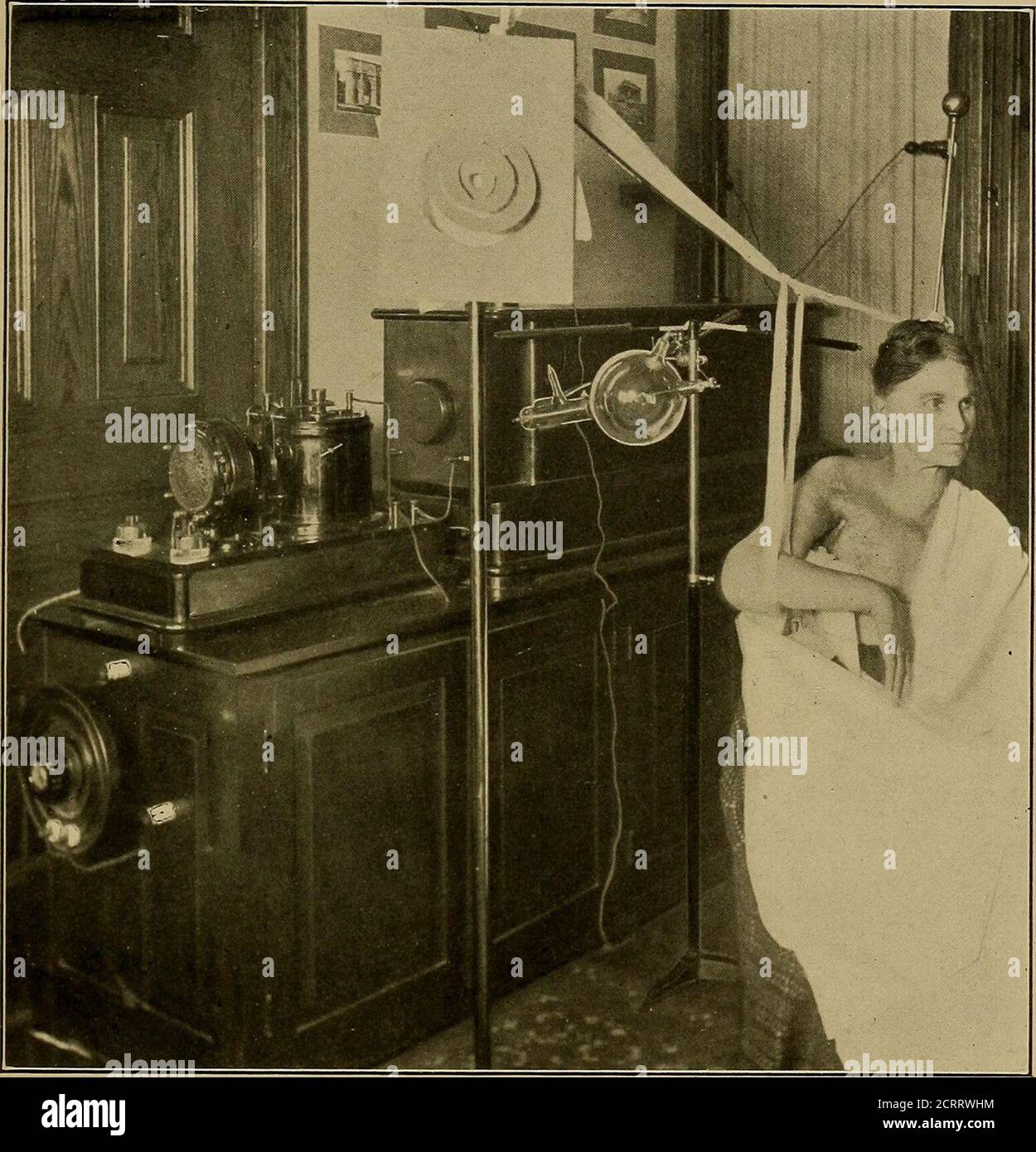 . Ein System der Ausbildung in Röntgenverfahren und medizinische Anwendungen von Licht, Heißluft, Vibration und Hochfrequenzströme : ein bildliches System der Lehre durch klinische Instruktionsplatten mit erklärendem Text : eine Reihe von fotografischen Kliniken in Standard-Anwendungen der wissenschaftlichen therapeutischen Apparaturen für chirurgische und medizinische Praktiker : Vorbereitet speziell für die postgraduale Heimstudie von Chirurgen, Hausärzten, Zahnärzten, Dermatologen und Spezialisten in der Behandlung von chronischen Krankheiten und Sanitariumpraxis. Nase war vollständig von neuer Haut bedeckt worden und sehr stark in verringert Stockfoto