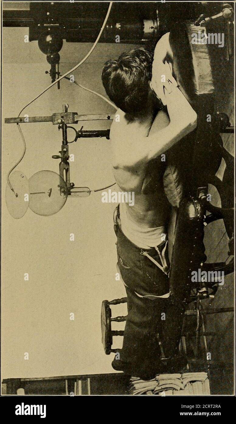 . Ein System der Ausbildung in Röntgenverfahren und medizinische Anwendungen von Licht, Heißluft, Vibration und Hochfrequenzströme : ein bildliches System der Lehre durch klinische Instruktionsplatten mit erklärendem Text : eine Reihe von fotografischen Kliniken in Standard-Anwendungen der wissenschaftlichen therapeutischen Apparaturen für chirurgische und medizinische Praktiker : Vorbereitet speziell für die post-Graduate-Home-Studie von Chirurgen, Allgemeinmedizinern, Zahnärzten, Dermatologen und Spezialisten in der Behandlung von chronischen Krankheiten und Sanitariumpraxis . Platte 118. - Röntgenbild des Kalkulus in der Gallenblase, durch Operation und verifiziert Stockfoto