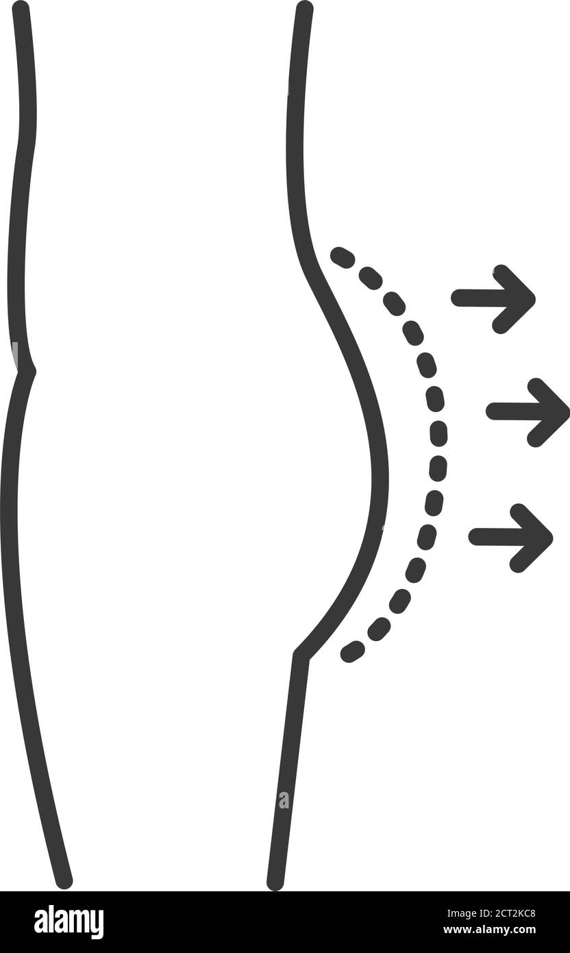 Symbol für schwarze Linie der Gesäßvergrößerung. Gluteoplastik-Konzept. Korrektur weibliche Figur. Plastische Körperchirurgie. Melden Sie sich für Webseite, mobile App, Banner an Stock Vektor