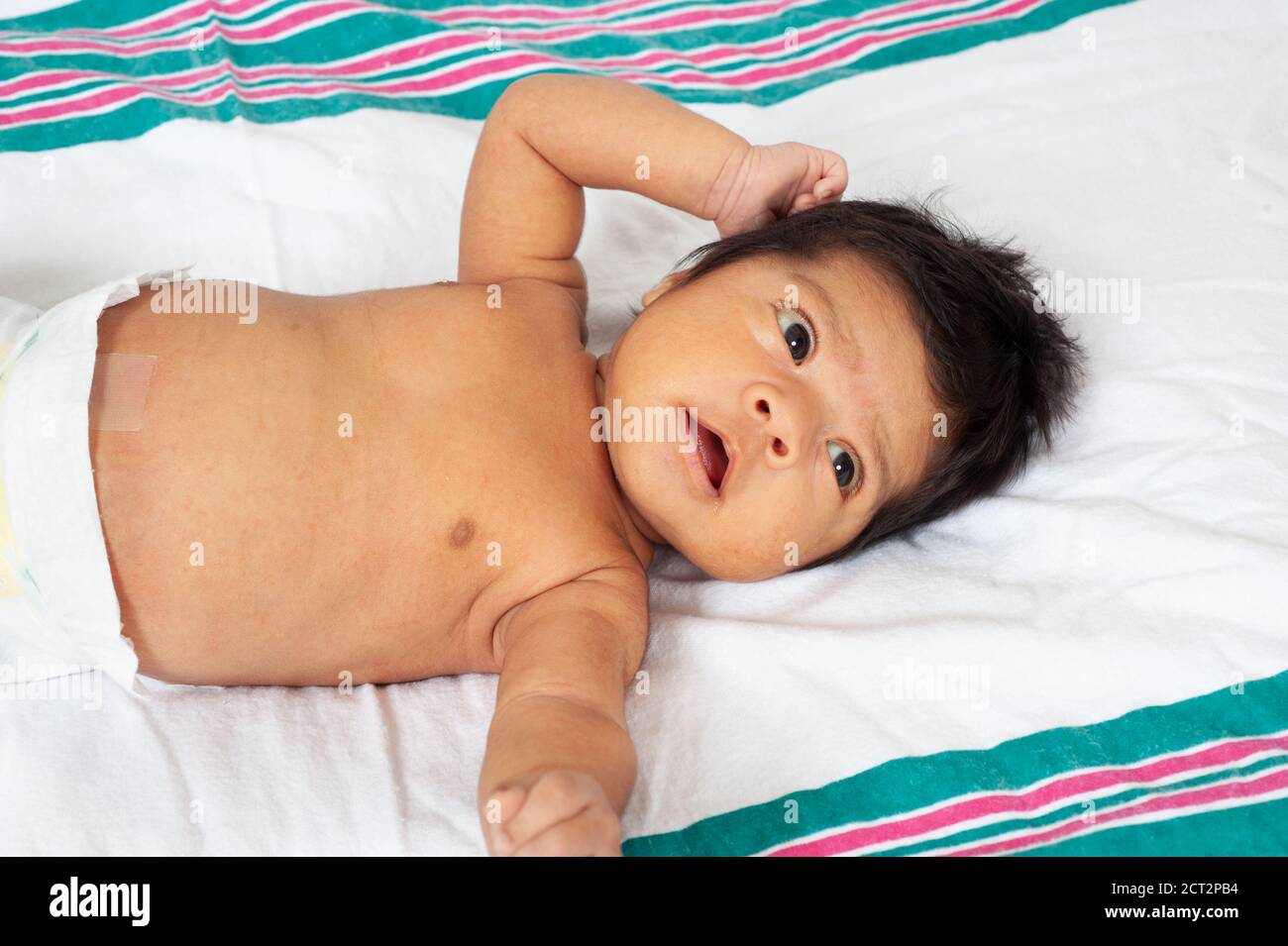 Tonic Nackenreflex bei Neugeborenen, ein Monat alt, auf dem Rücken liegend, Nahaufnahme Stockfoto