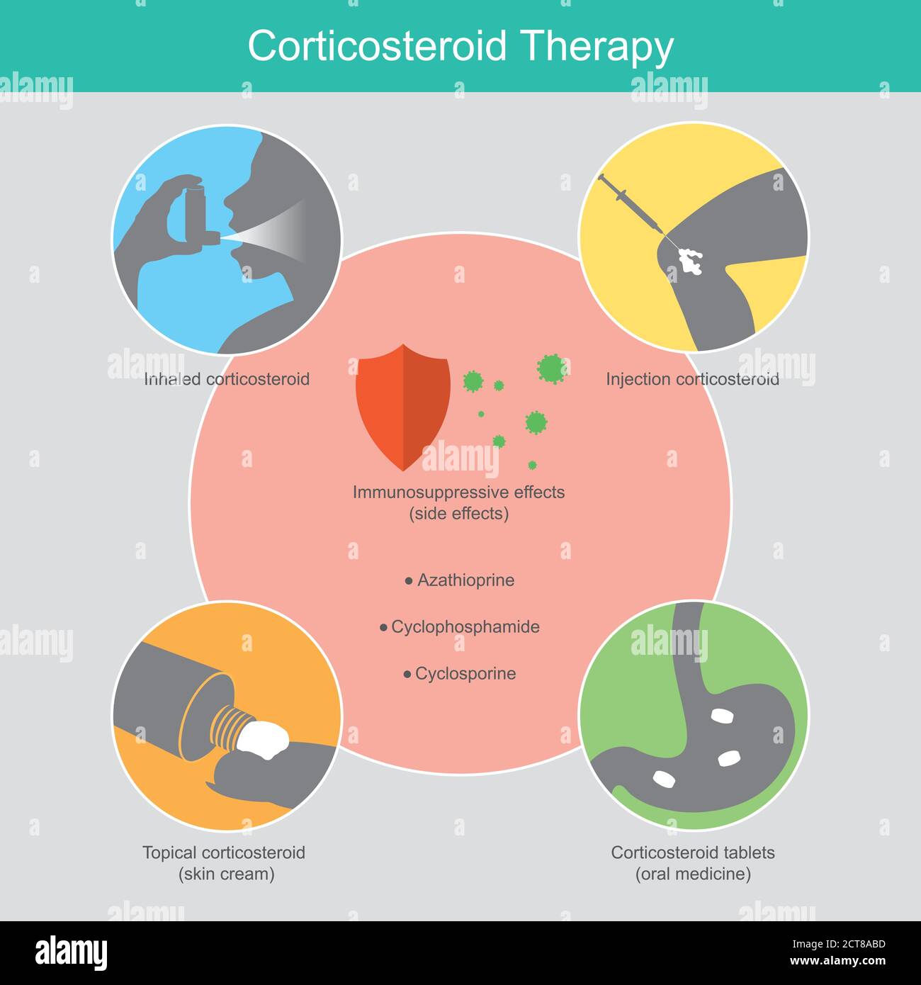 Corticosteroid-Therapie. Illustration erklären die Therapie entzündliche Erkrankung beim Menschen durch Verwendung synthetischer. Stock Vektor