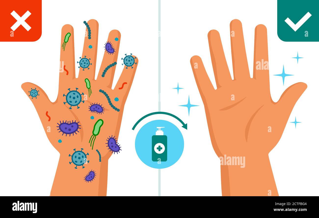 Schmutzige und saubere Hände, vor und nach der Verwendung von Desinfektionsmittel oder Seife, Händewaschen und Hygienekonzept Stock Vektor