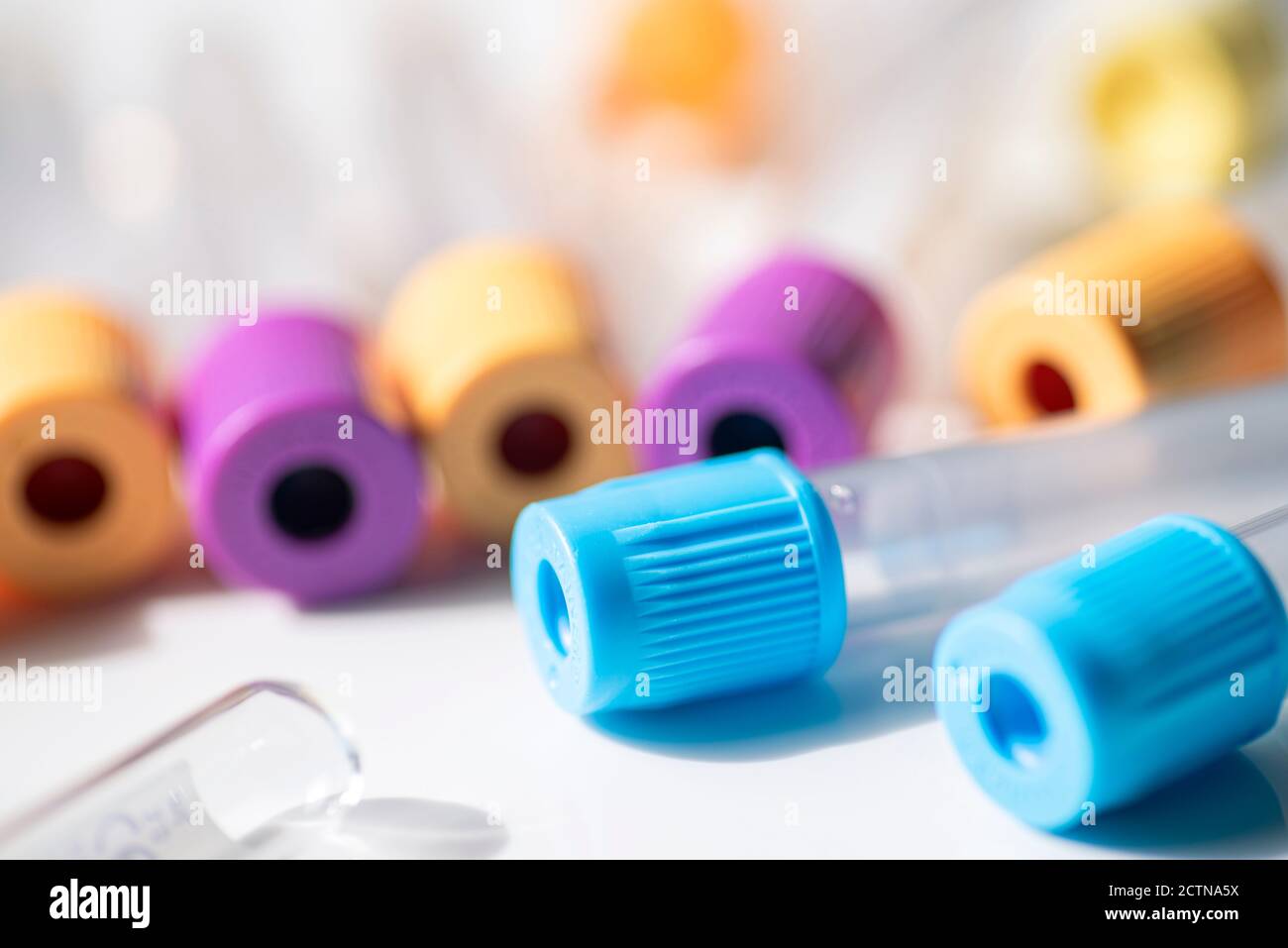 Verschiedene Röhrchen zur Entnahme von Blutproben Stockfoto