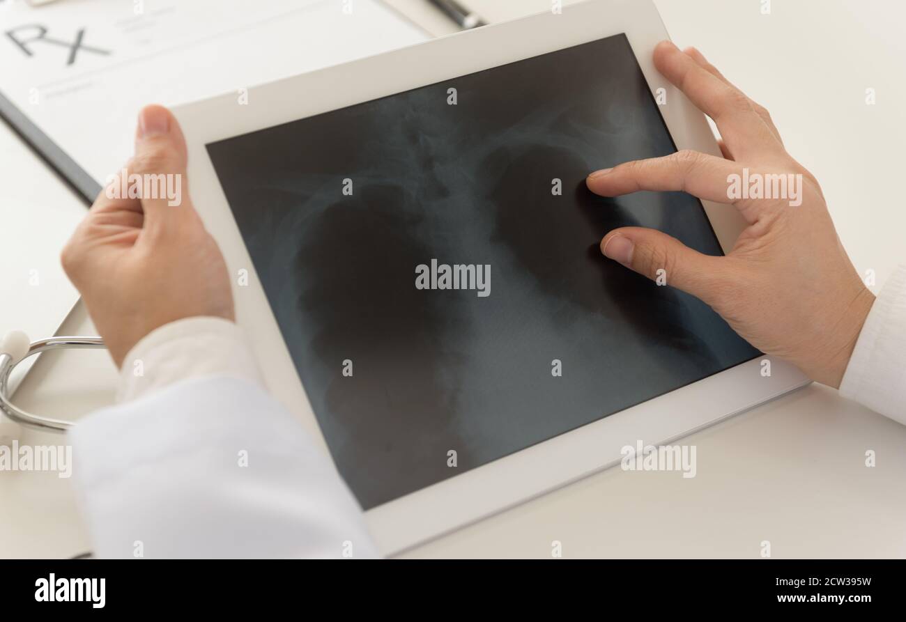 Arzt zur Untersuchung der Röntgen-Lungenradiographie in einem Tablet-Computer im Krankenhaus. Stockfoto