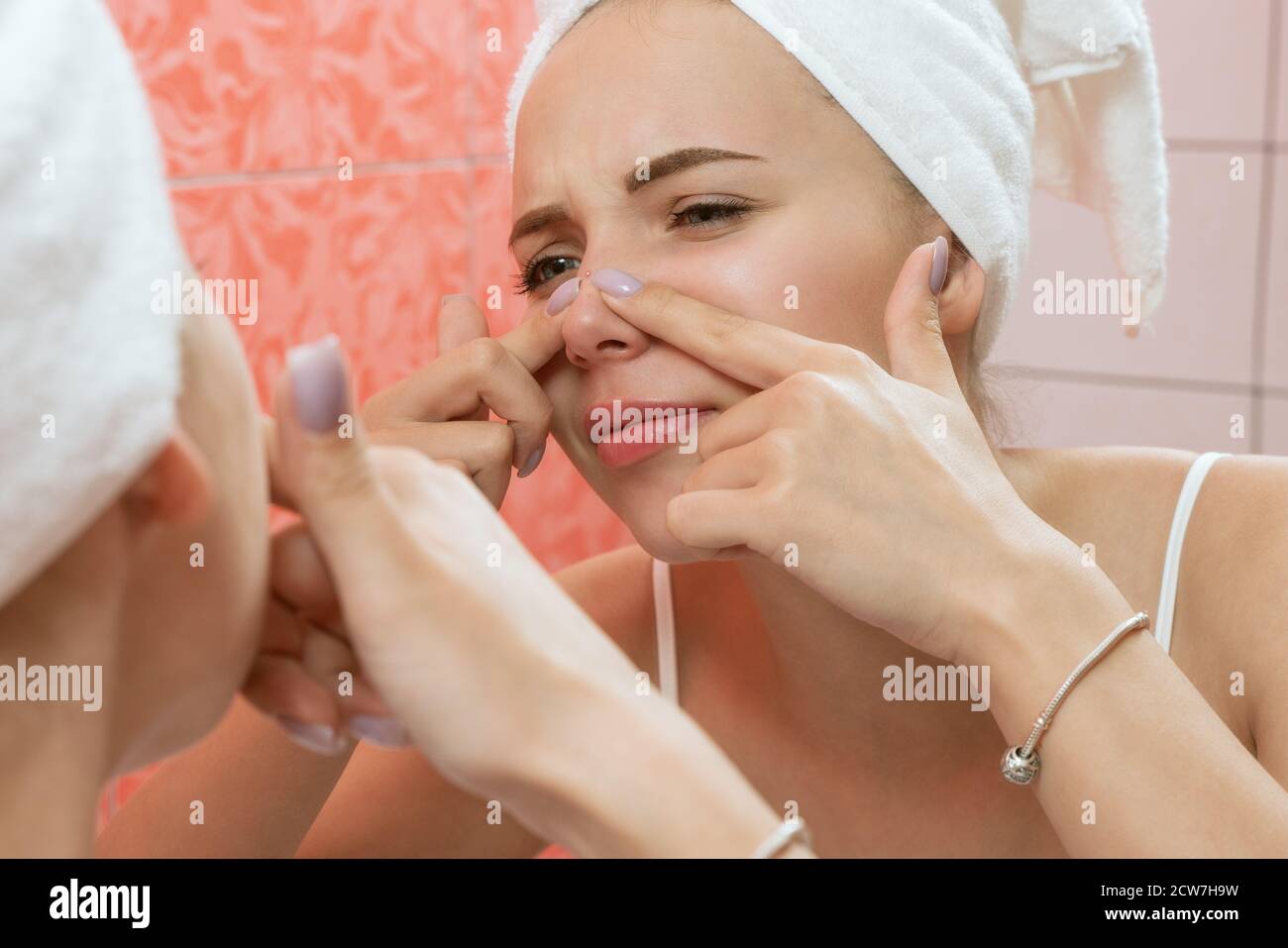 Junge Frau suchen und quetschen Akne auf einem Gesicht vor dem Spiegel. Hässlich Problem Haut Mädchen, teen Mädchen mit Pickel. Hautpflege. Schönheit Stockfoto