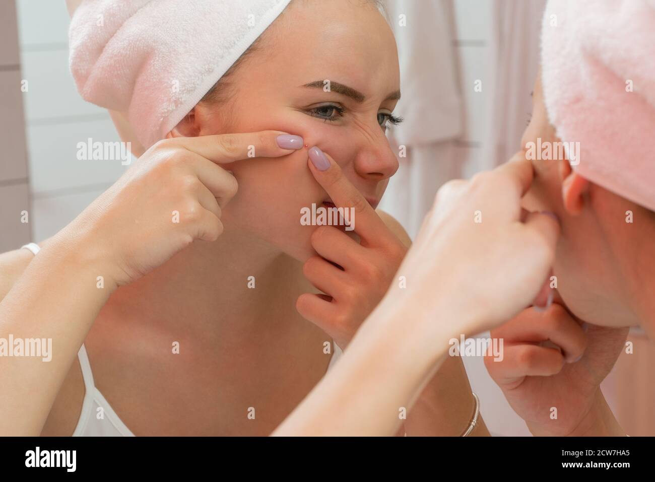 Junge Frau suchen und quetschen Akne auf einem Gesicht vor dem Spiegel. Hässlich Problem Haut Mädchen, teen Mädchen mit Pickel. Hautpflege. Schönheit Stockfoto