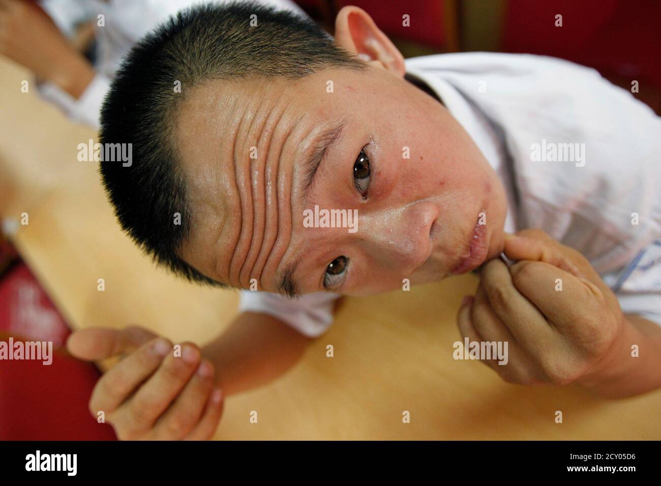 Agent Orange Victim Vietnam Stockfotos Und Bilder Kaufen Alamy Agent Orange Victim Vietnam Stockfotos Und Bilder Kaufen Alamy
