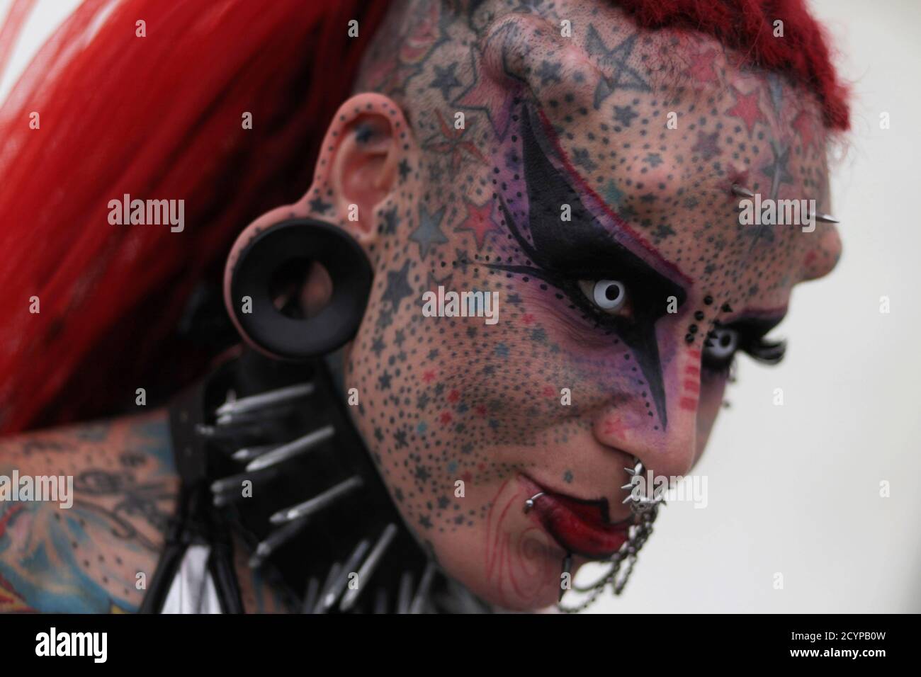 Korperimplantate Stockfotos Und Bilder Kaufen Alamy