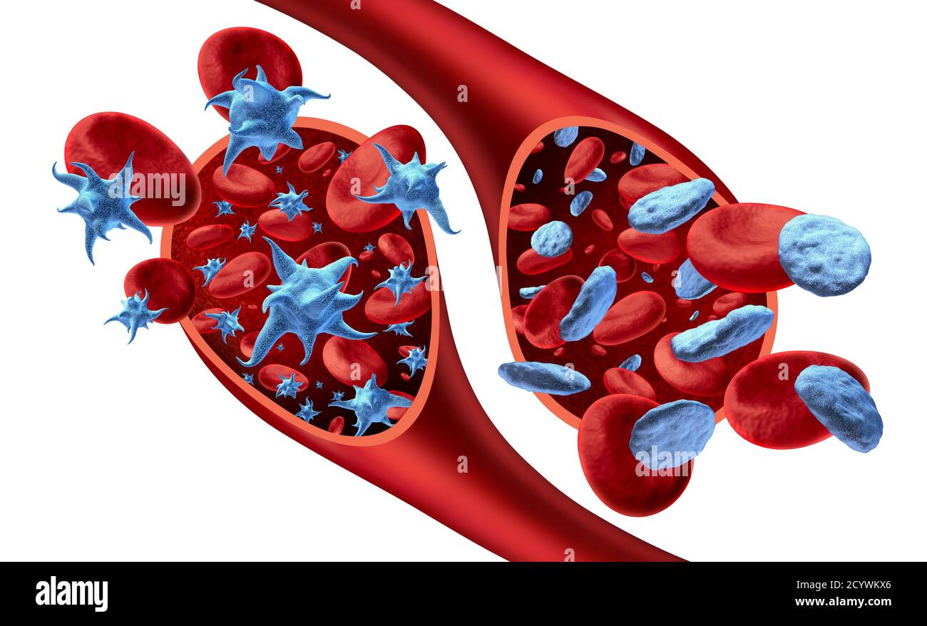 Thrombozyten und nicht aktivierte Thrombozyten im Blut und Thrombozytenanatomie Konzept als aktivierte Thrombozyten fließen in einer Arterie oder Vene als 3D-Render. Stockfoto