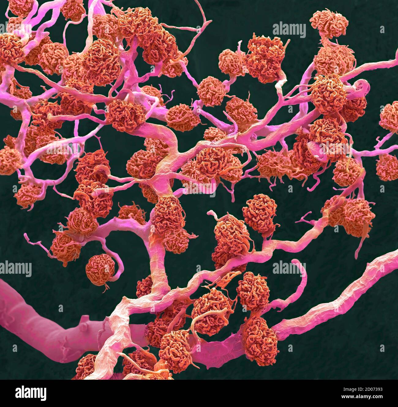 Nierenglomeruli. Farbiger Rasterelektronenmikrograph (SEM) eines Harzgegossens aus Glomeruli-Kapillaren und den größeren Blutgefäßen, die sie mit ihnen versorgen Stockfoto
