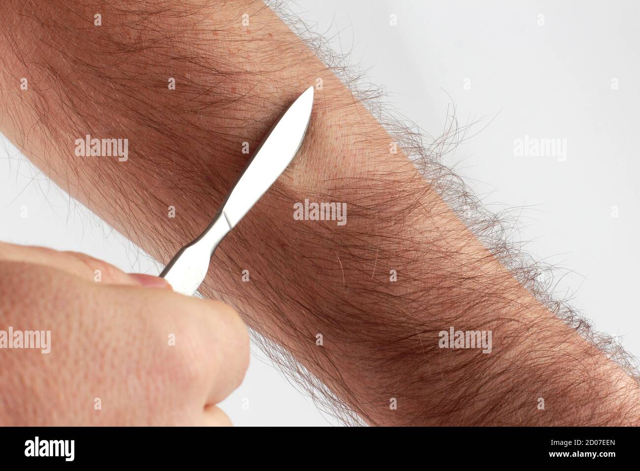 Arm Haare Stockfotos Und Bilder Kaufen Alamy