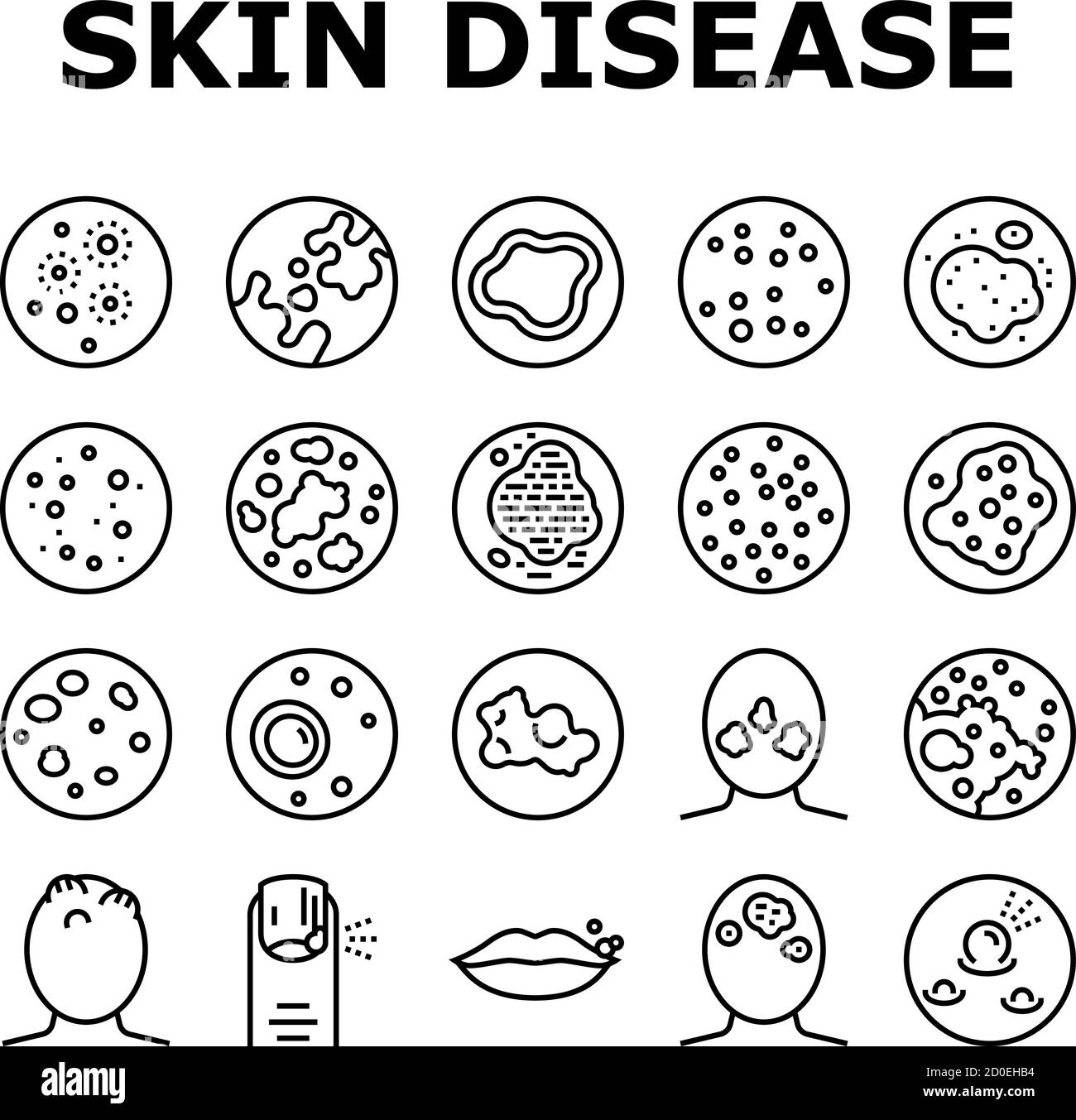 Skin Disease Symptom Collection Icons Set Vector Stock Vektor