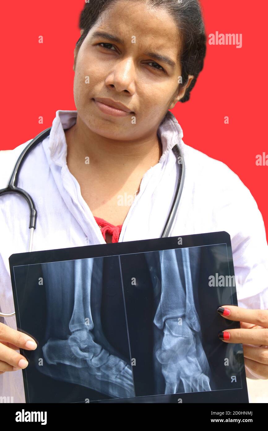 Junge Ärztin mit Röntgen trägt Laborkittel und lächelndes Gesicht mit roten isolierten Hintergrund. Stockfoto