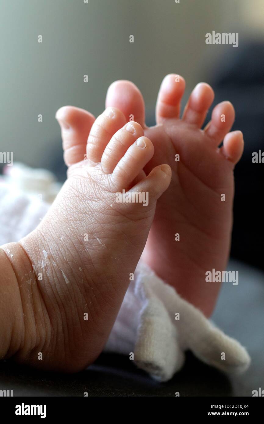 Ein Porträt der kleinen niedlichen Füße eines Babys. Die Haut schält sich  ein wenig vom Fuß des Neugeborenen. Die zehn winzigen Zehen sind sichtbar  und die beiden Füße sind Stockfotografie - Alamy