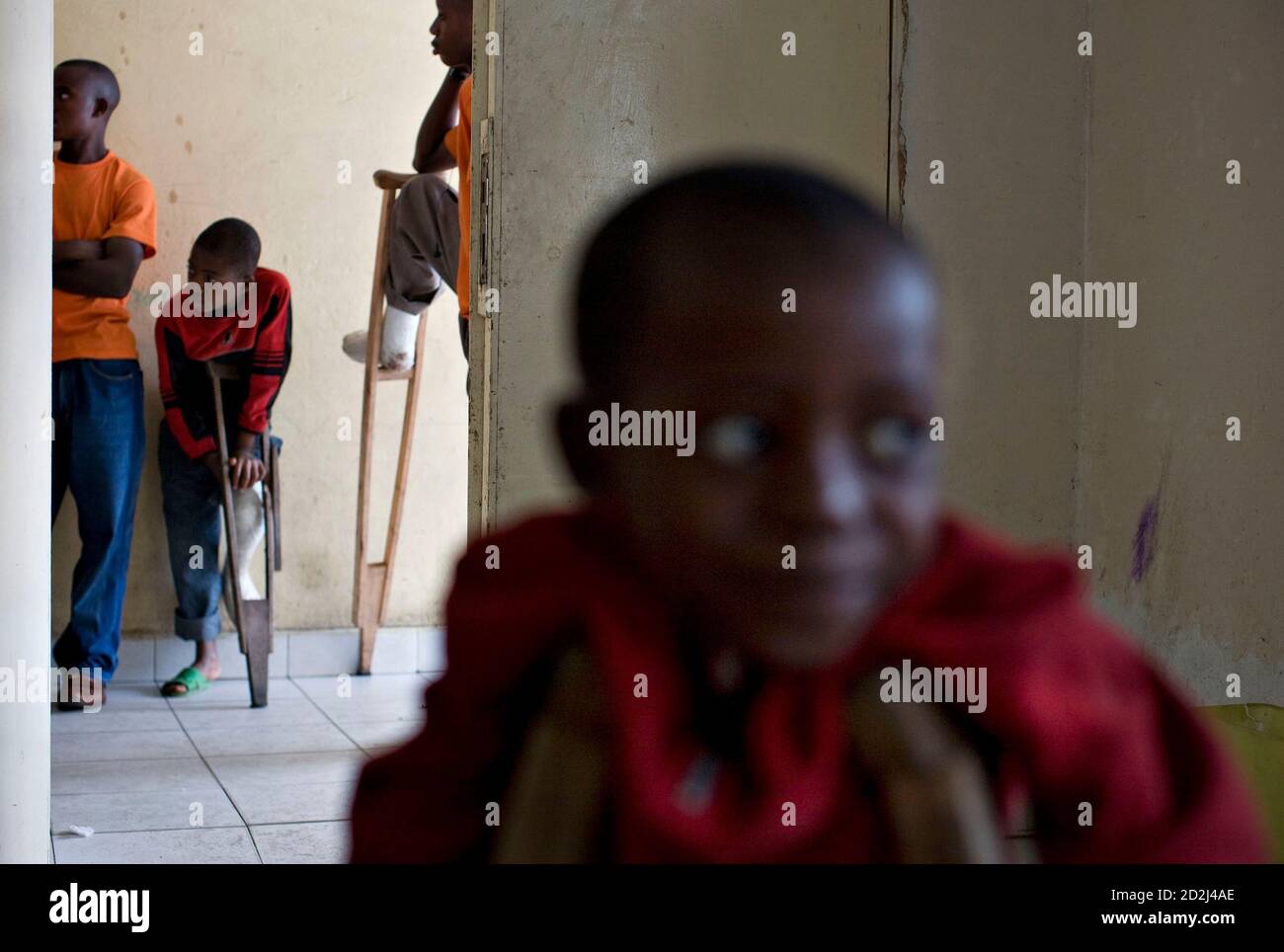Leg Polio Stockfotos Und Bilder Kaufen Alamy