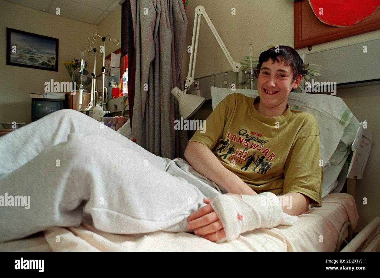 Der 17-jährige Carl Pointon aus Ellesmere, Shropshire, erhält eine Krebsbehandlung am Birmingham Children's Hospital und profitiert von der United Kingdom Children's Cancel Study Group, die morgen (Donnerstag) im Birmingham International Convention Centre ihr 20jähriges Treffen abhält. Foto von David Jones/PA. Stockfoto