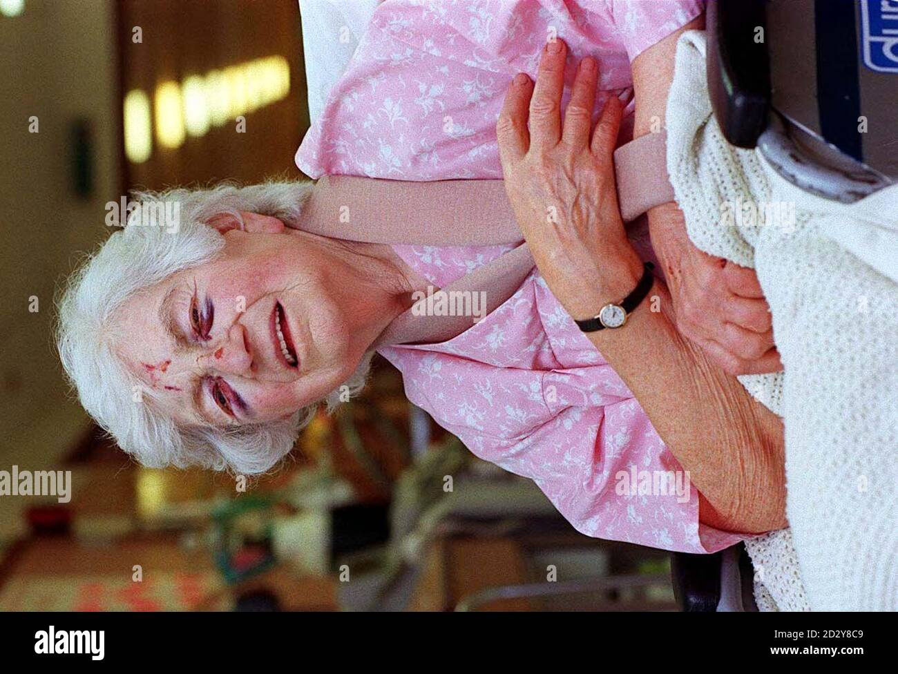 Die 84-jährige Madeline Levasseur aus Erdington, Birmingham, erlitt am Dienstagabend einen gebrochenen Arm und einen gebrochenen Kragenknochen, als sie von einem Räuber auf den Boden gestoßen wurde, während sie zur Kirche ging. Miss Levasseur wird heute (Donnerstag) im Good Hope Hospital, Sutton Coldfield, bei der Genesung abgebildet. Foto von David Jones. SEHEN SIE SICH DIE PA-GESCHICHTE AN. Stockfoto