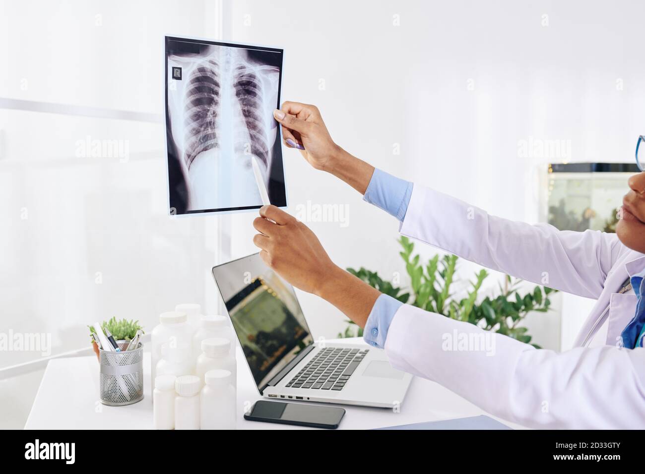 Pneumologe, der Röntgenaufnahmen des Brustkorbs untersucht Stockfoto