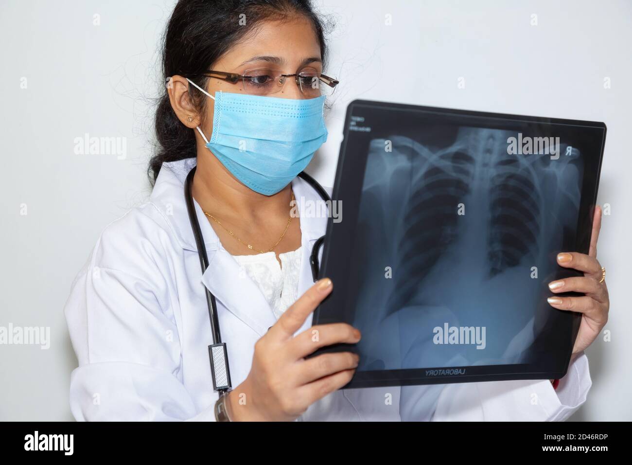 Ein Arzt in Indien untersucht eine Röntgenstrahlenplatte des Brustkorbs an einem Medizinische Klinik Stockfoto