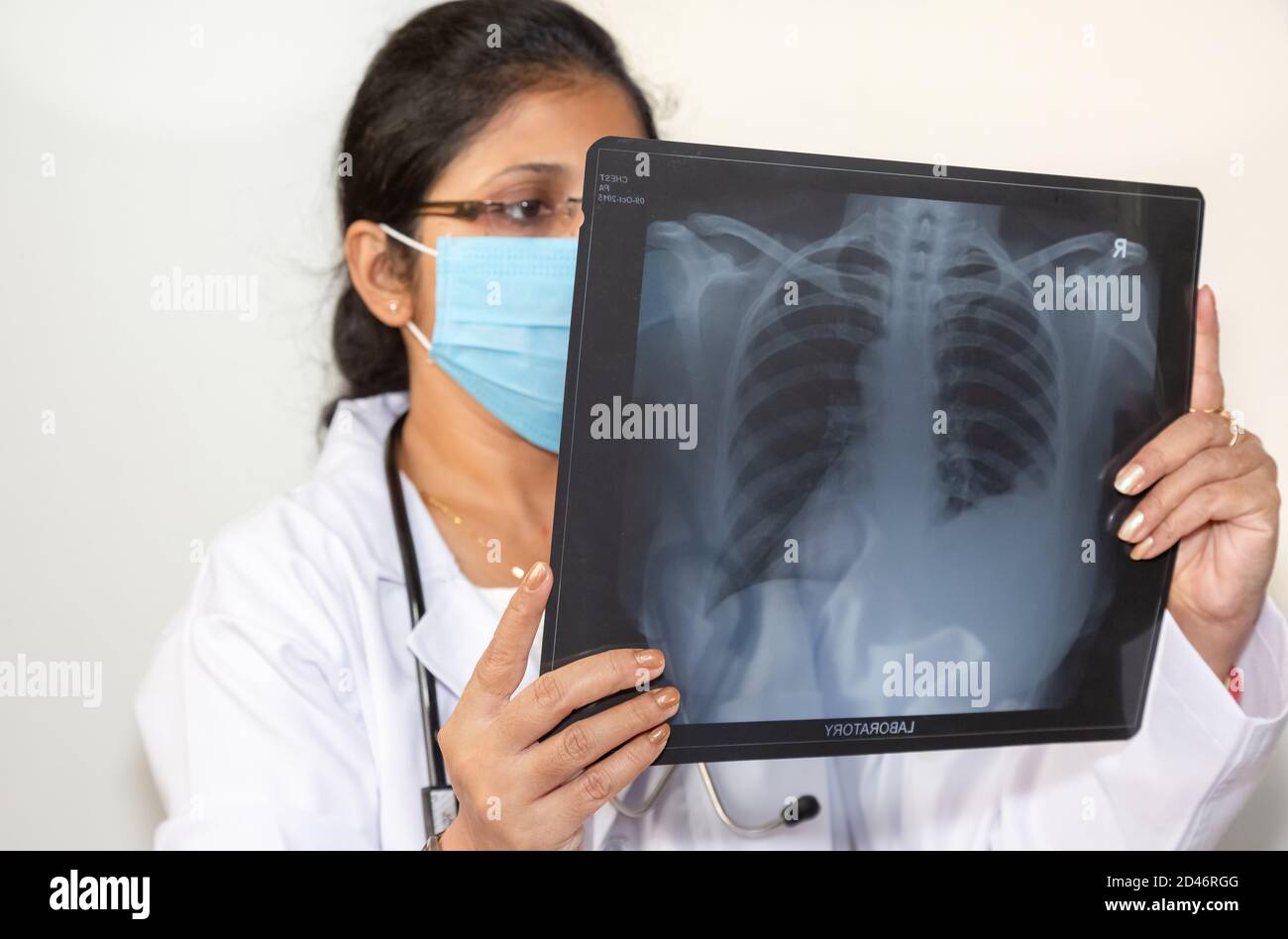 Ein Arzt in Indien untersucht eine Röntgenstrahlenplatte des Brustkorbs an einem Medizinische Klinik Stockfoto