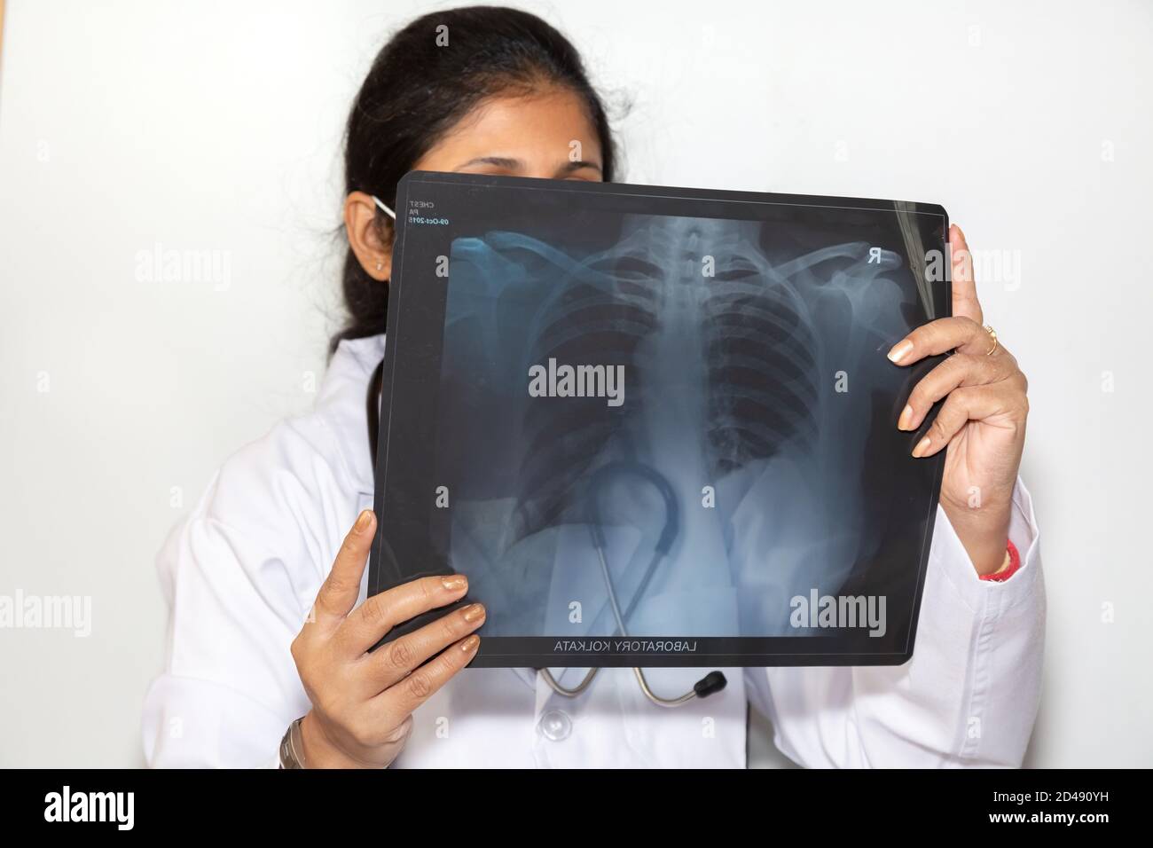 Ein Arzt in Indien untersucht eine Röntgenstrahlenplatte des Brustkorbs an einem Medizinische Klinik Stockfoto