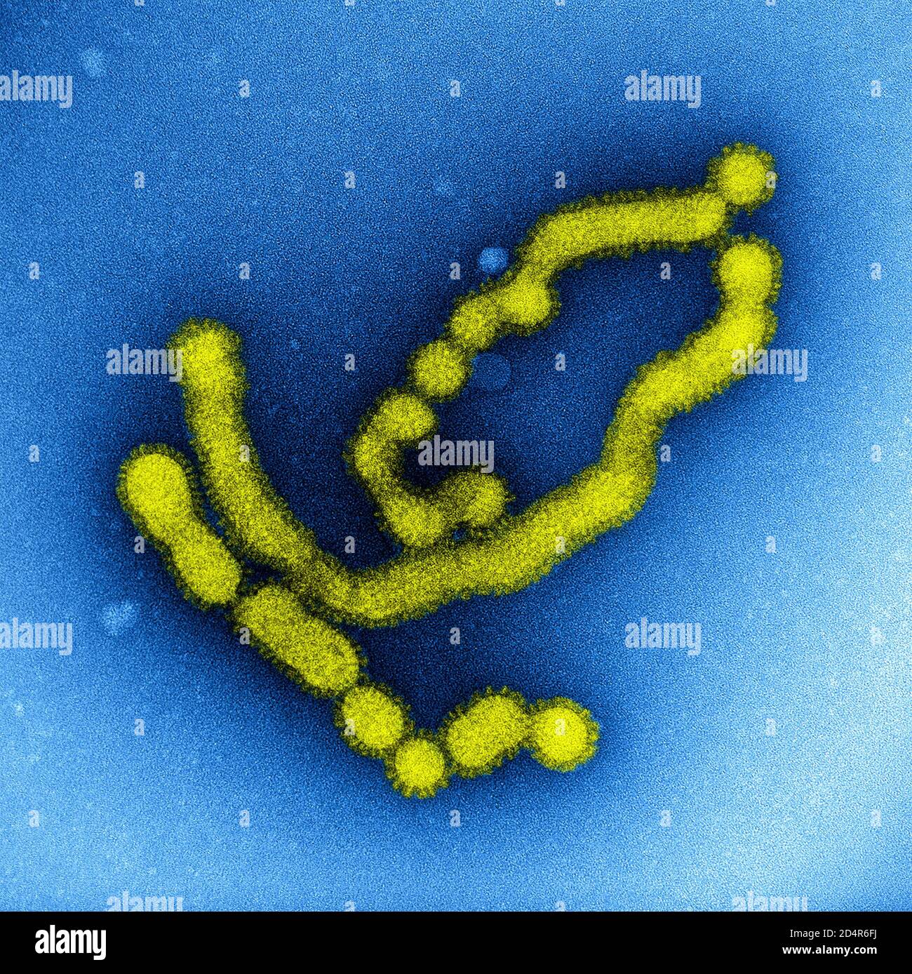 Schweinegrippe-Stamm Viruspartikel Kolorierte Transmissionselektronenmikrographie von negativ gefärbten SW31 (Schweinegrippe) Influenza-Viruspartikeln. Credi Stockfoto